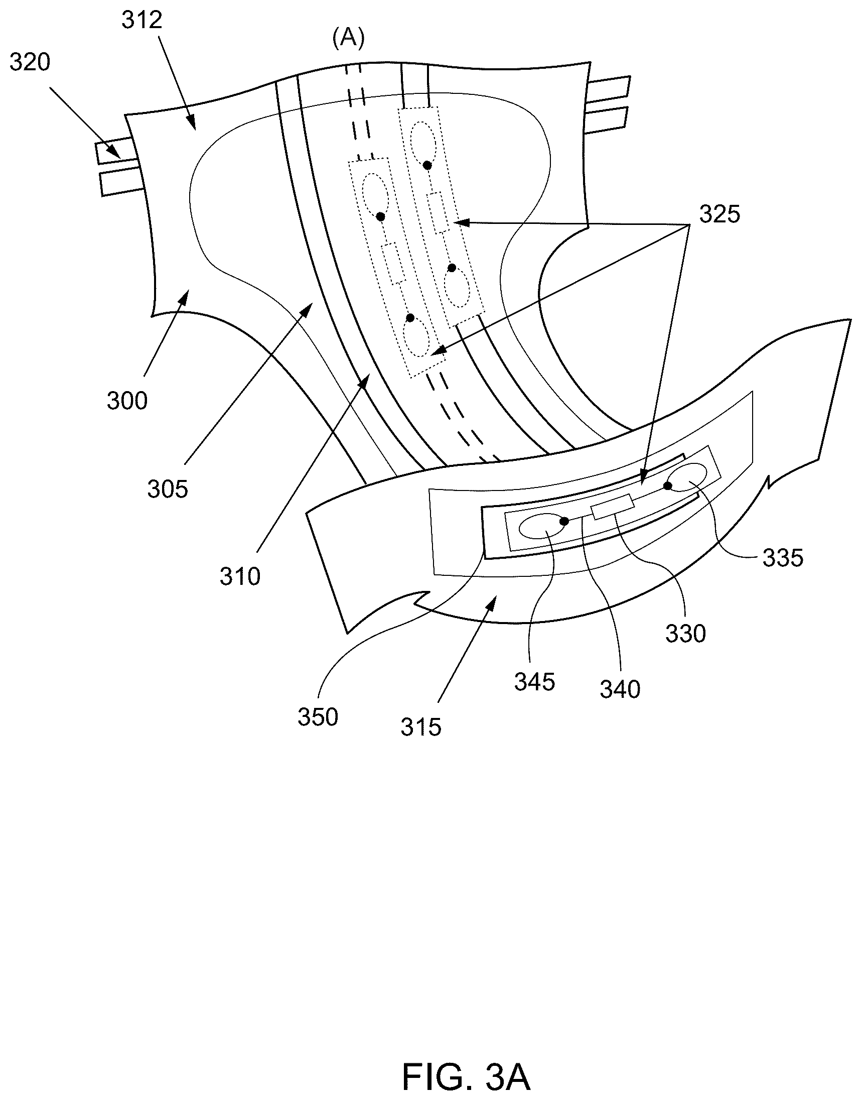 Patent US12551381 Figure 3 – Internet of things (IoT) solution for management of urinary incontinence