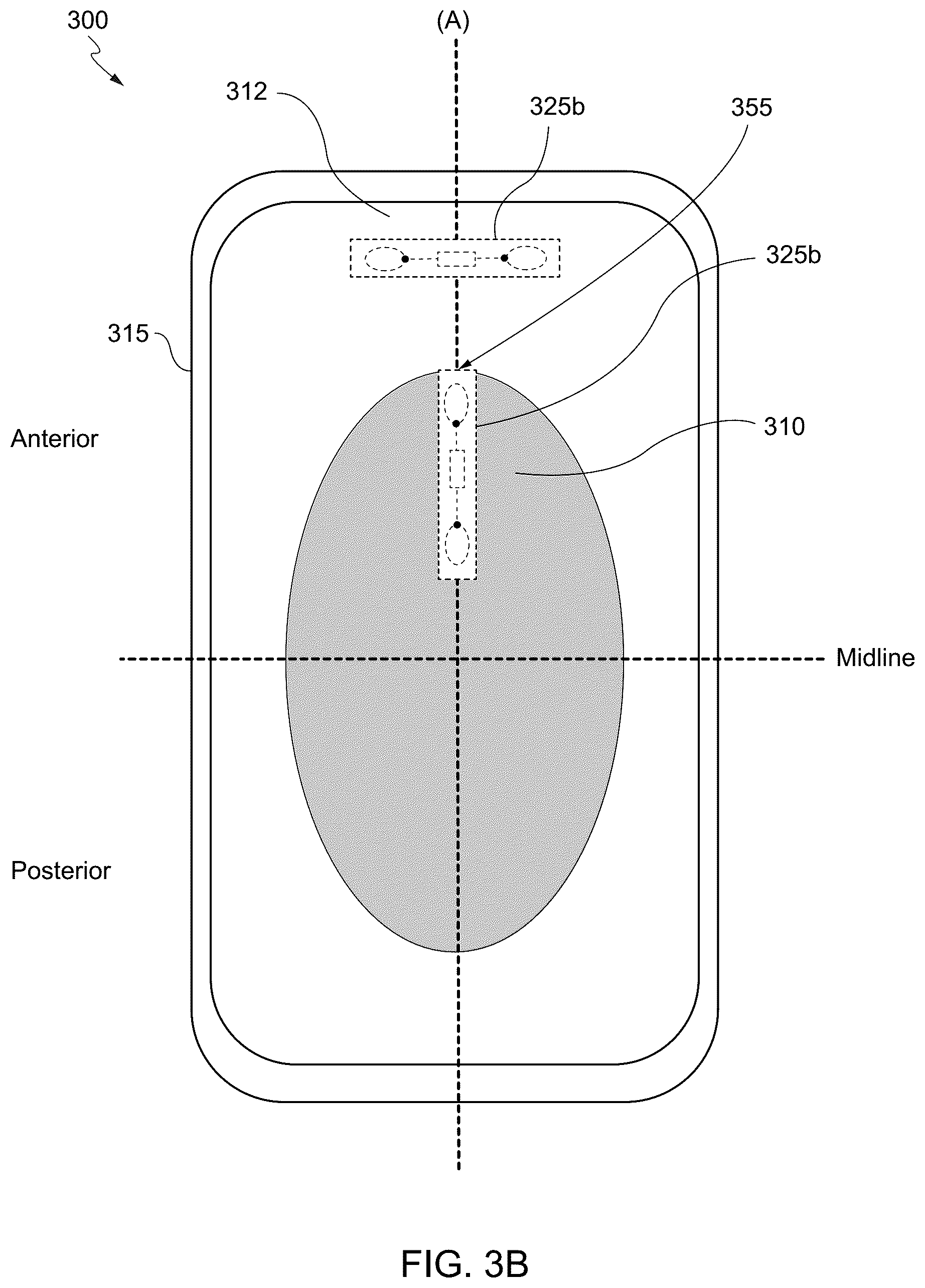 Patent US12551381 Figure 4 – Internet of things (IoT) solution for management of urinary incontinence