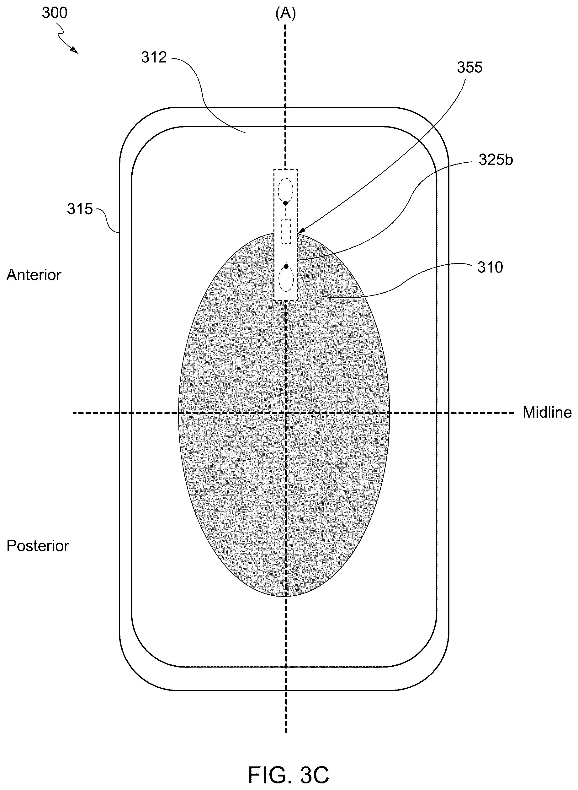 Patent US12551381 Figure 5 – Internet of things (IoT) solution for management of urinary incontinence