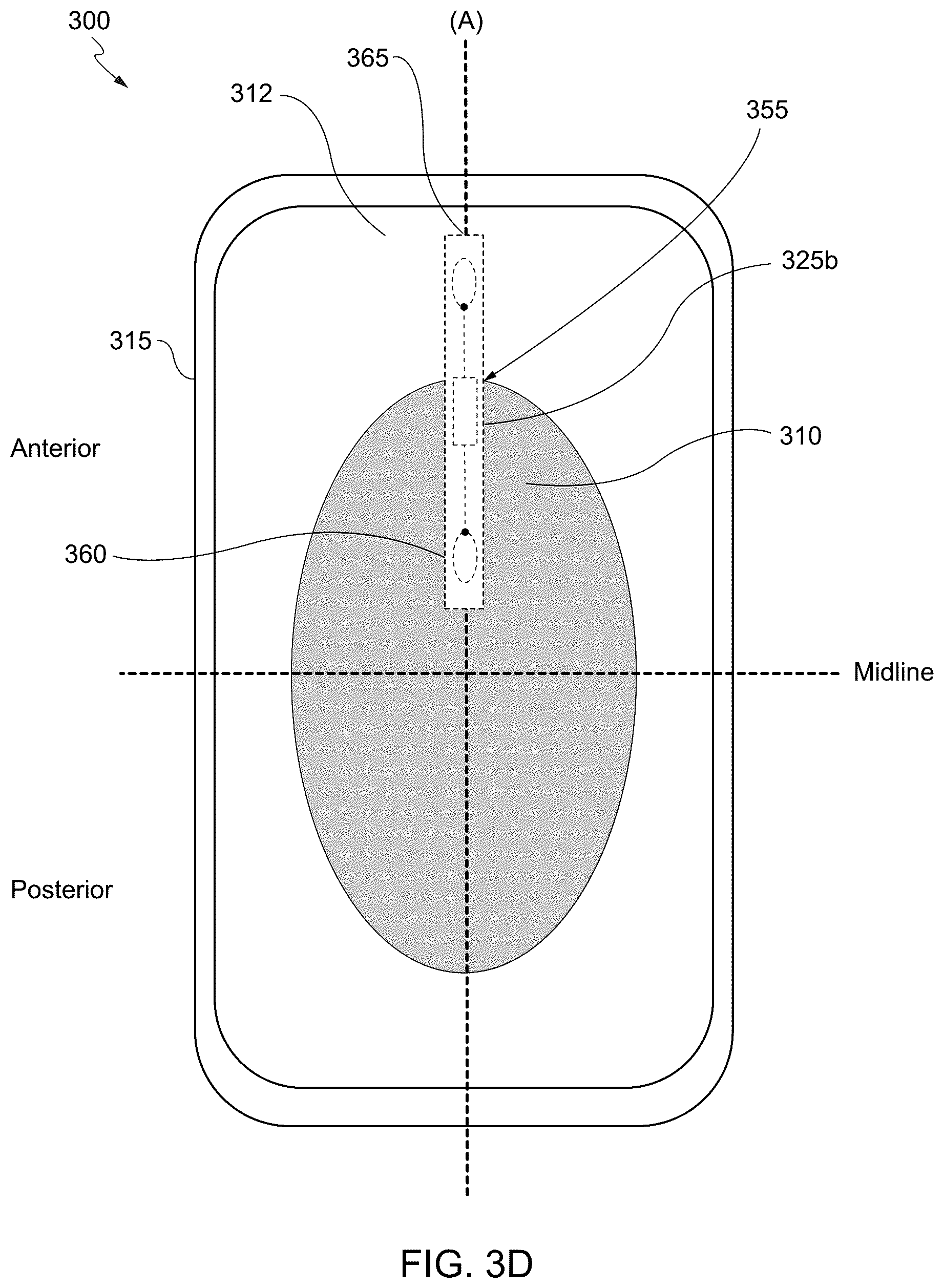 Patent US12551381 Figure 6 – Internet of things (IoT) solution for management of urinary incontinence