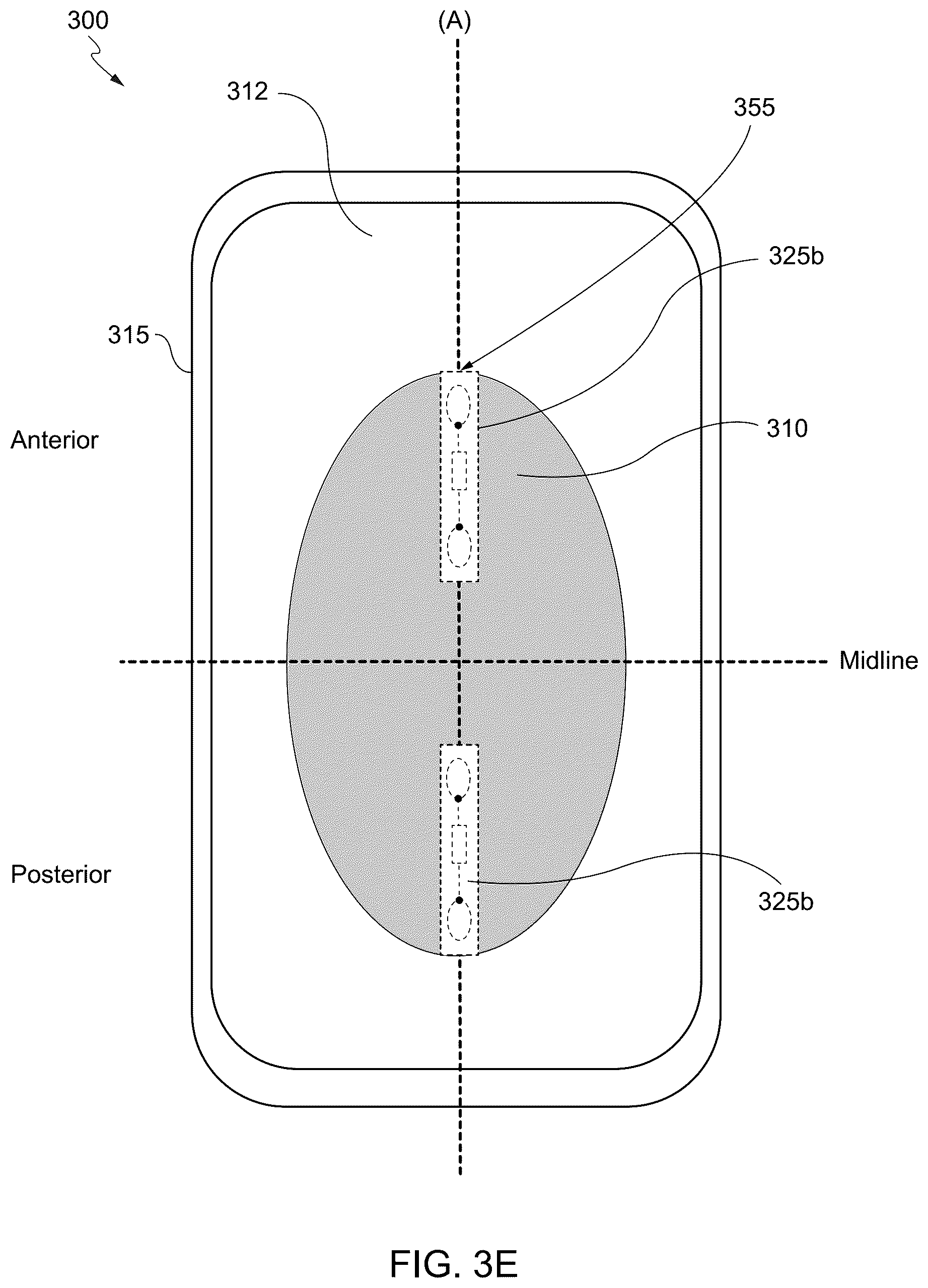 Patent US12551381 Figure 7 – Internet of things (IoT) solution for management of urinary incontinence