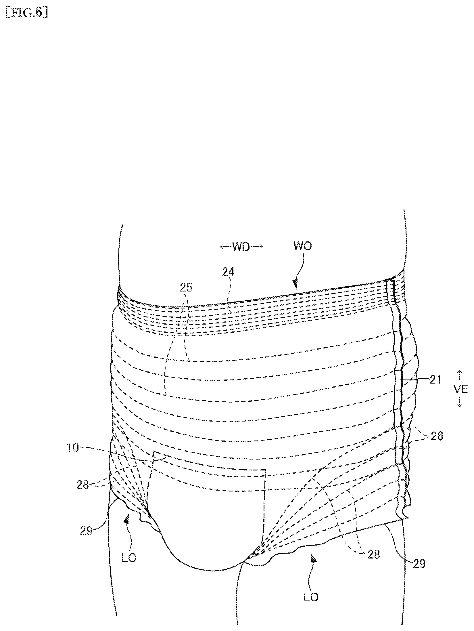 Patent US12551382 Figure 6 – Disposable wearing article