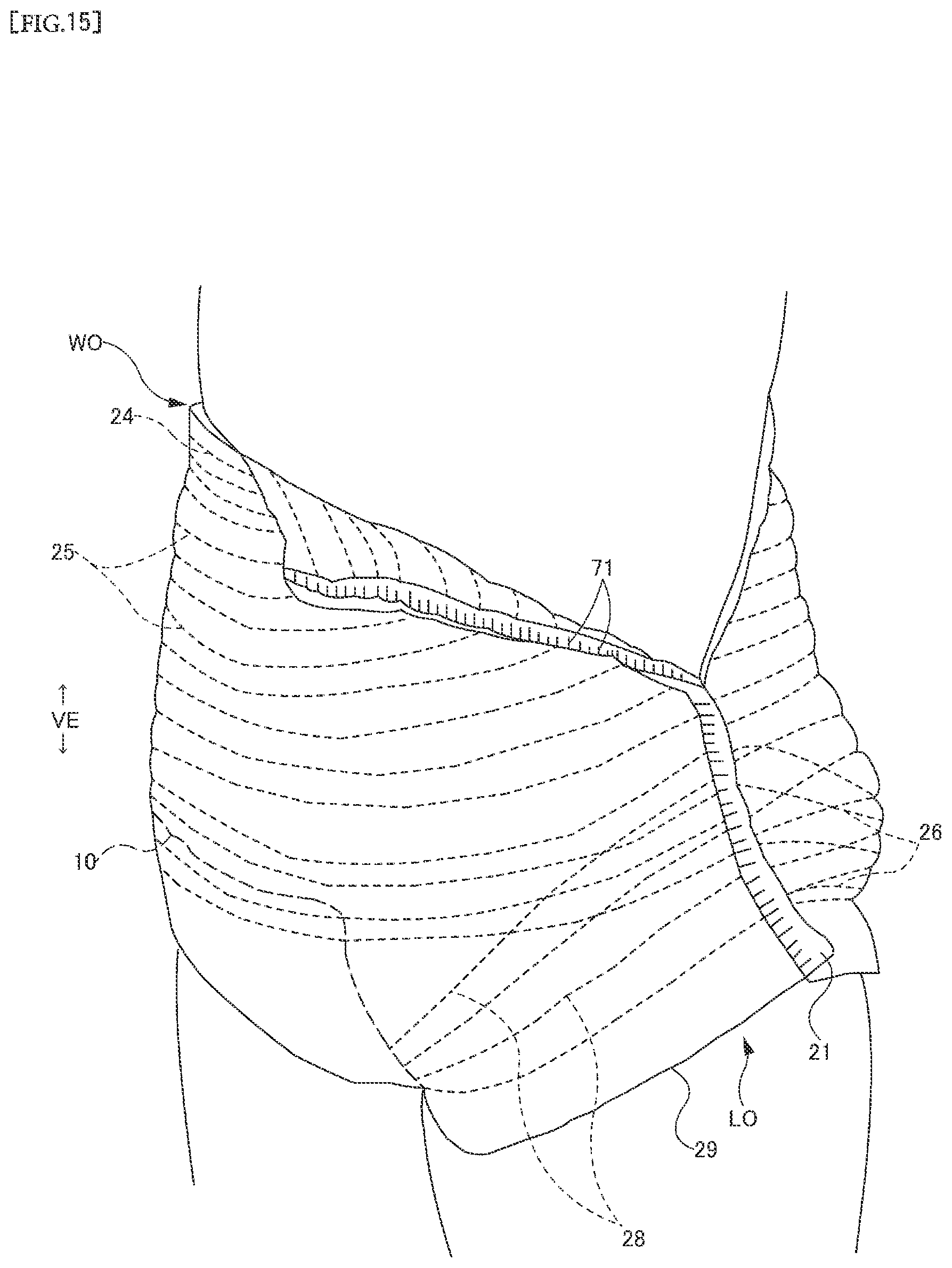 Patent US12551382 Figure 15 – Disposable wearing article