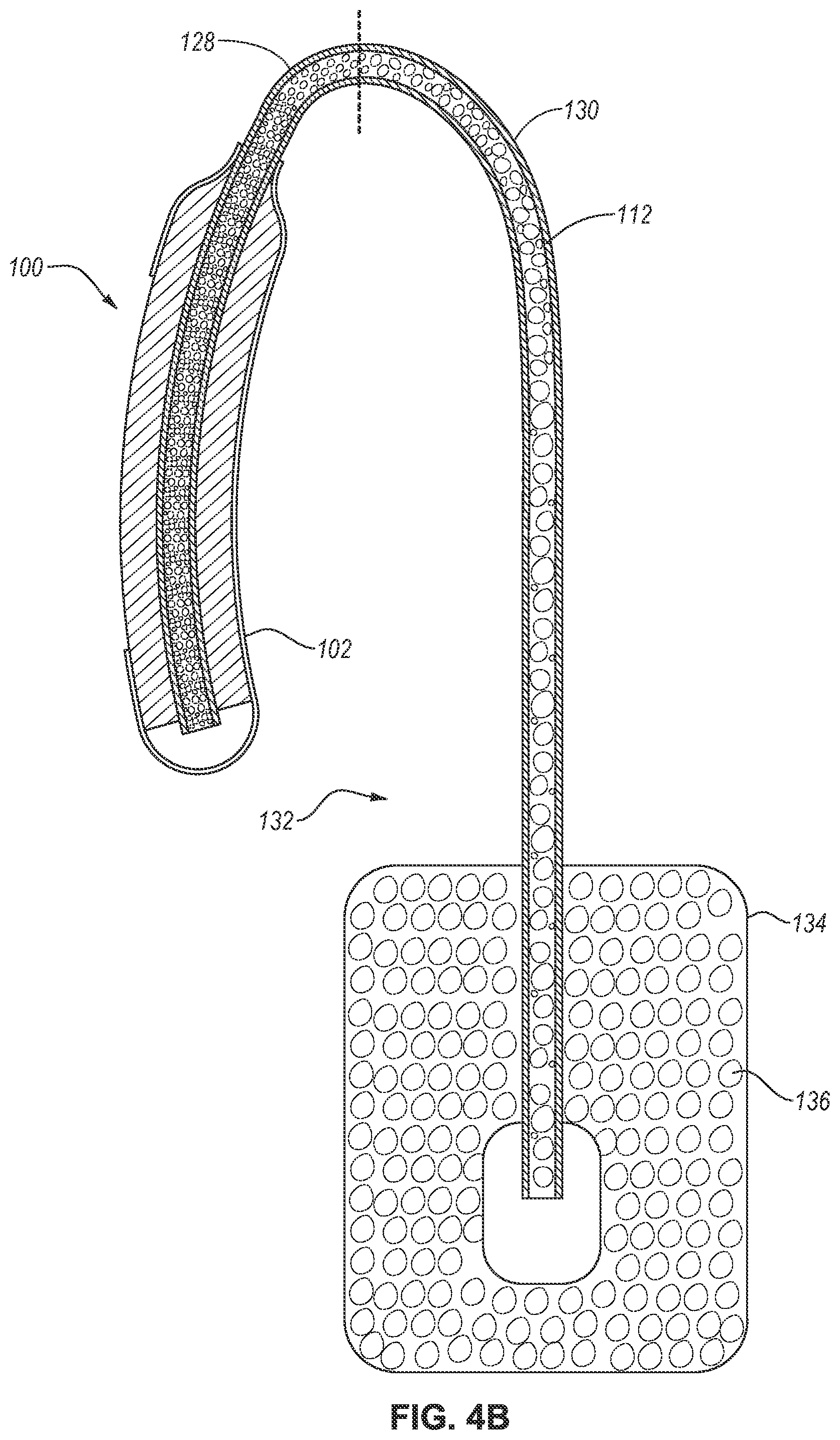 Patent US12551385 Figure 5 – Fluid collection assembly including a tube having porous wicking material for improved fluid transport