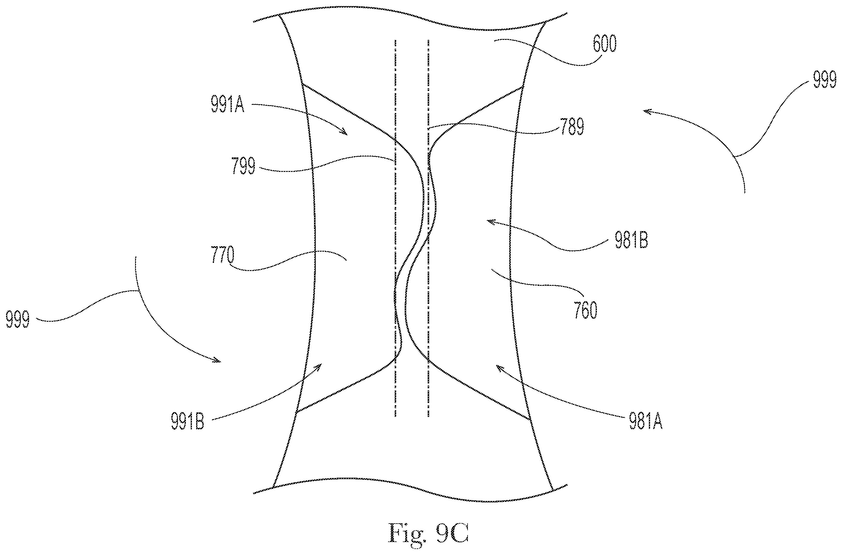 Patent US12551386 Figure 19 – Feminine hygiene article with improved wings
