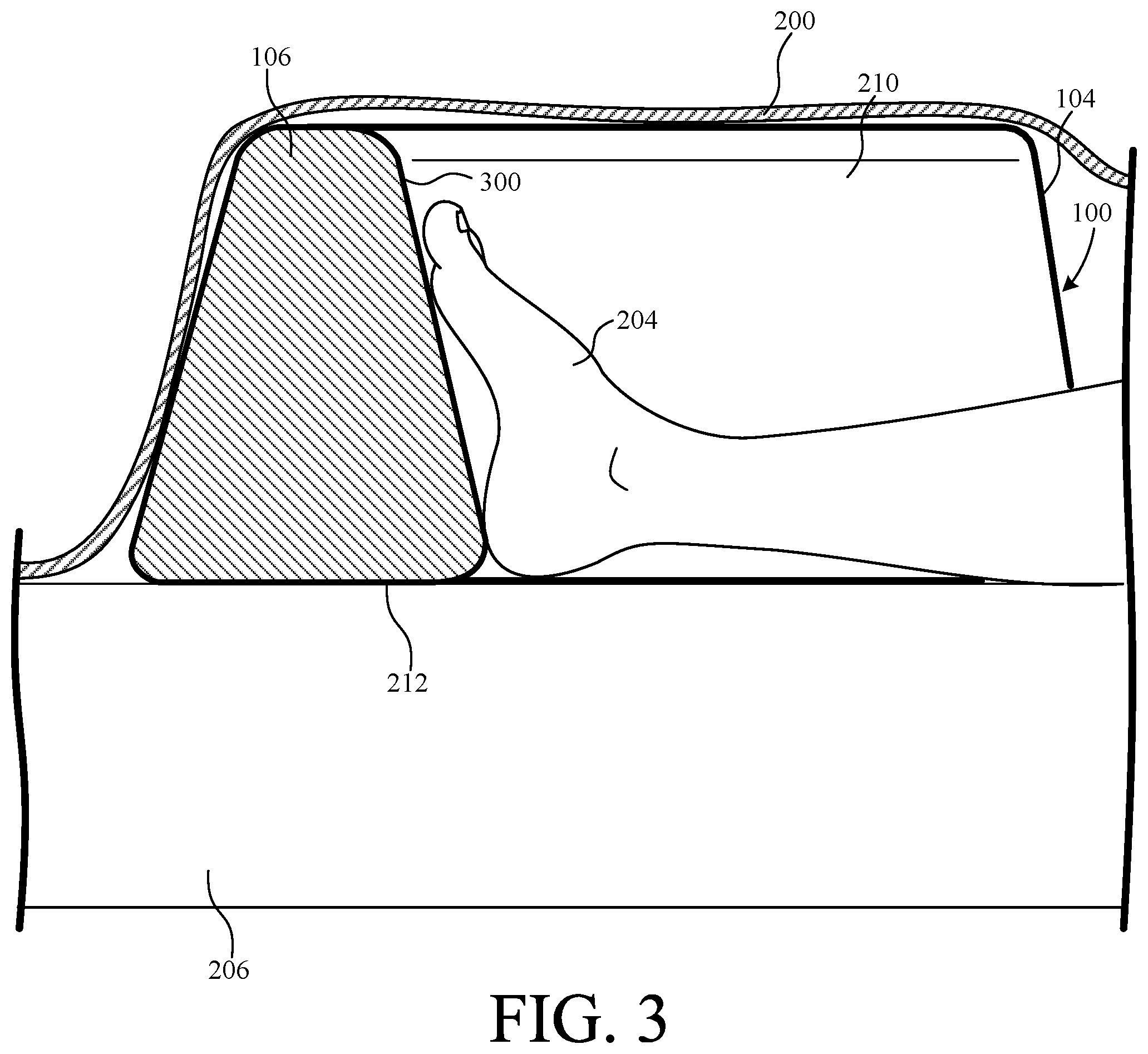 Patent US12551392 Figure 3 – Foot support device