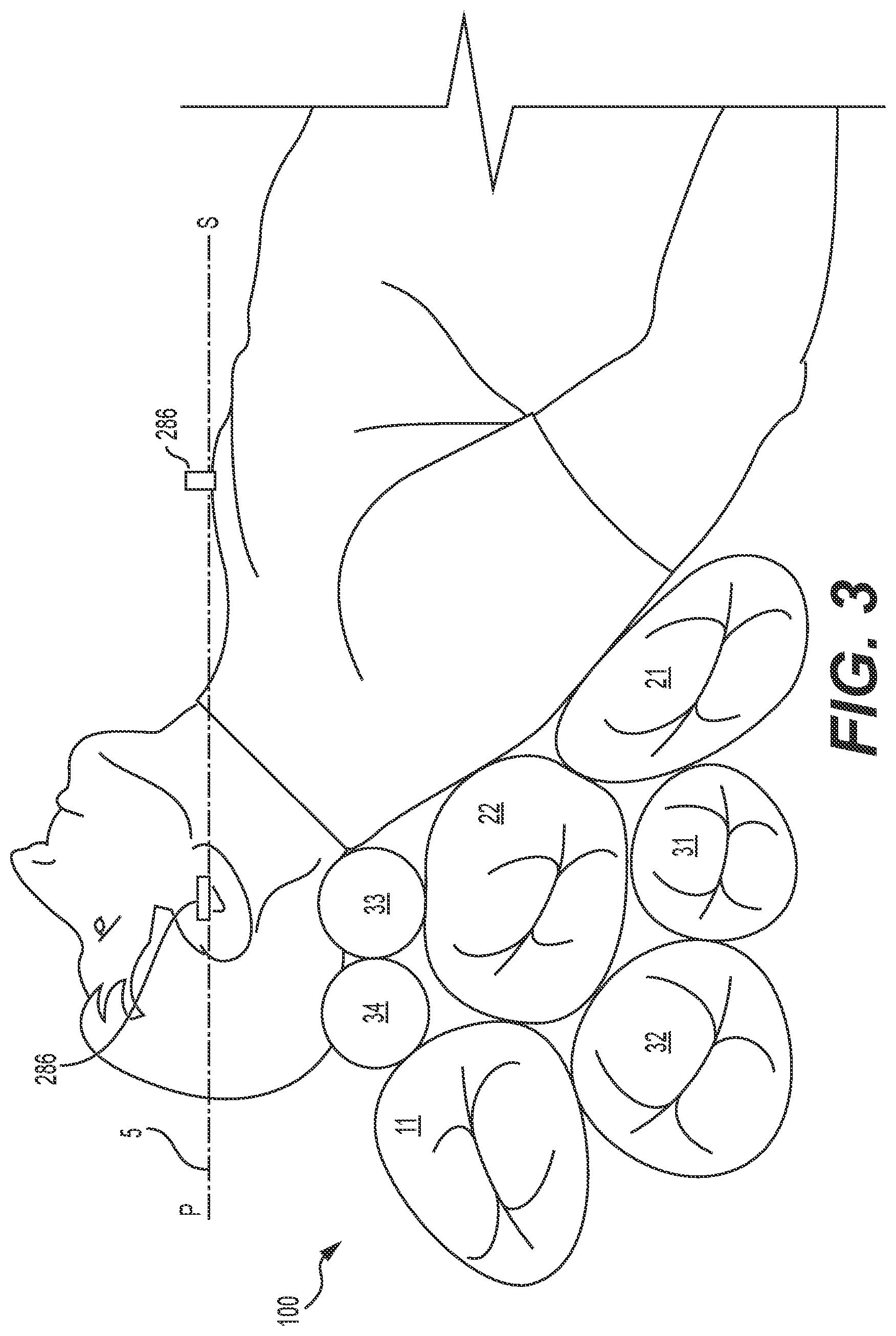 Patent US12551394 Figure 5 – Electro-mechanical controller to support air-pressure-based patient positioning