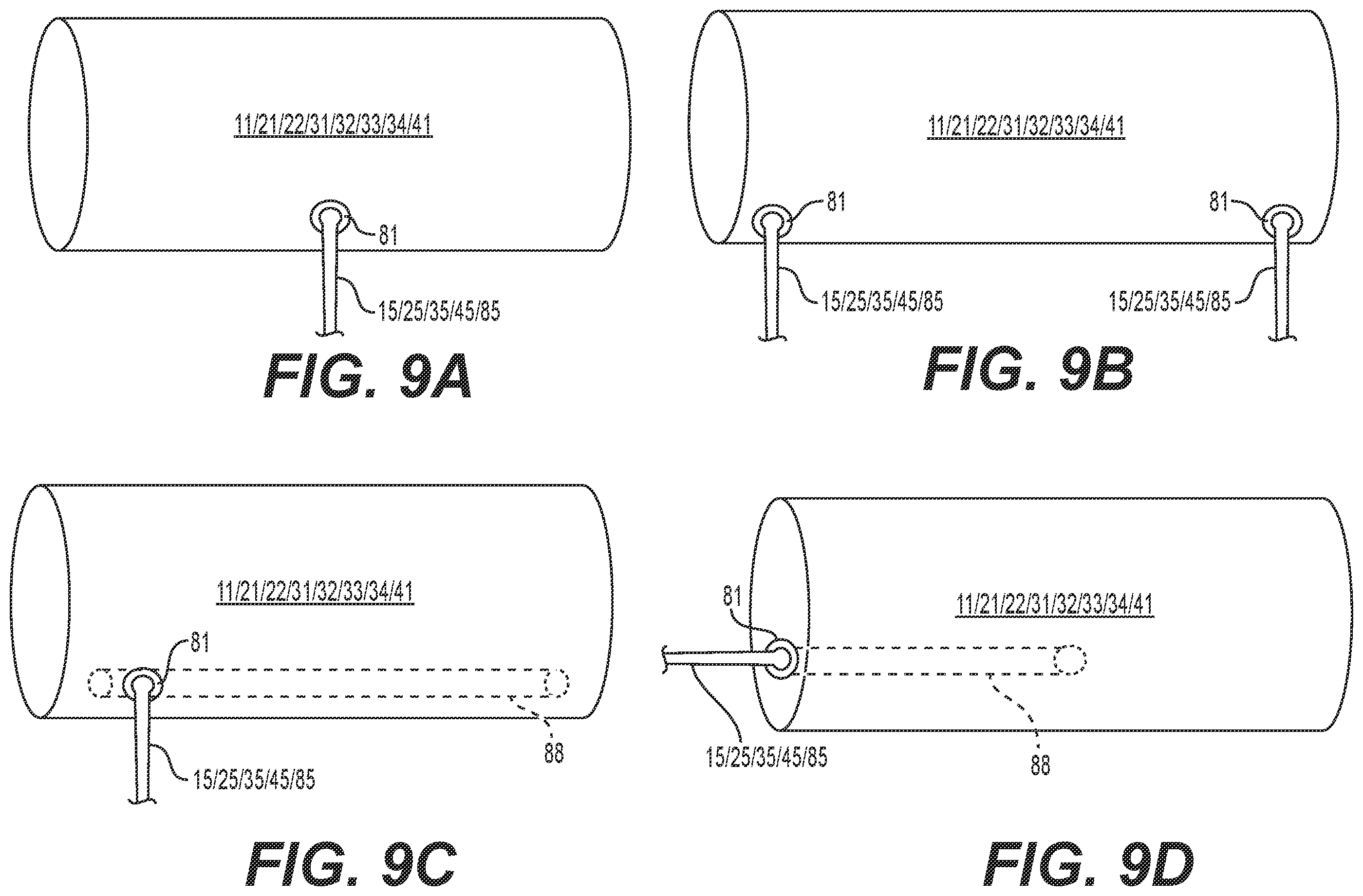 Patent US12551394 Figure 11 – Electro-mechanical controller to support air-pressure-based patient positioning