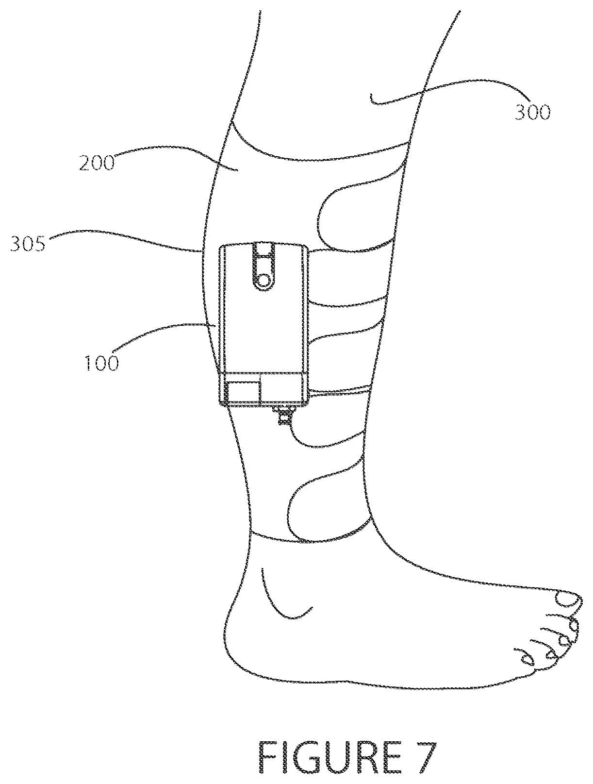 Patent US12551396 Figure 7 – Portable intermittent pneumatic compression system