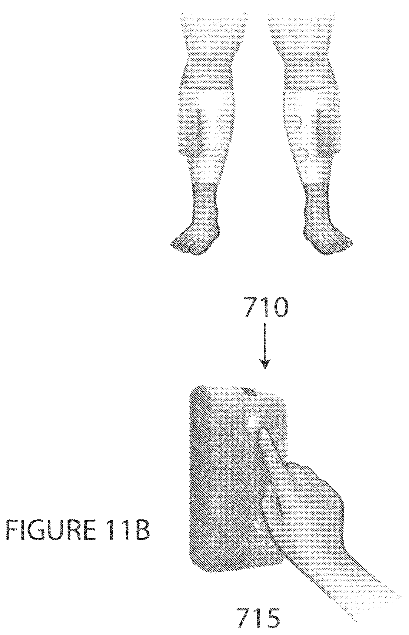 Patent US12551396 Figure 12 – Portable intermittent pneumatic compression system