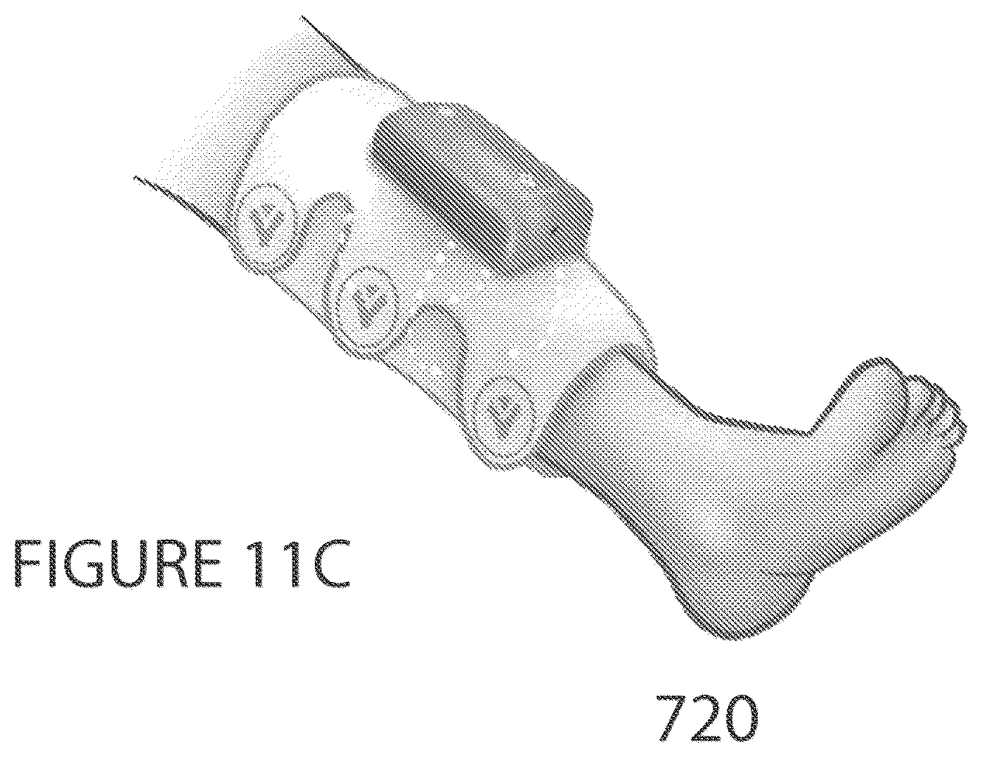 Patent US12551396 Figure 13 – Portable intermittent pneumatic compression system