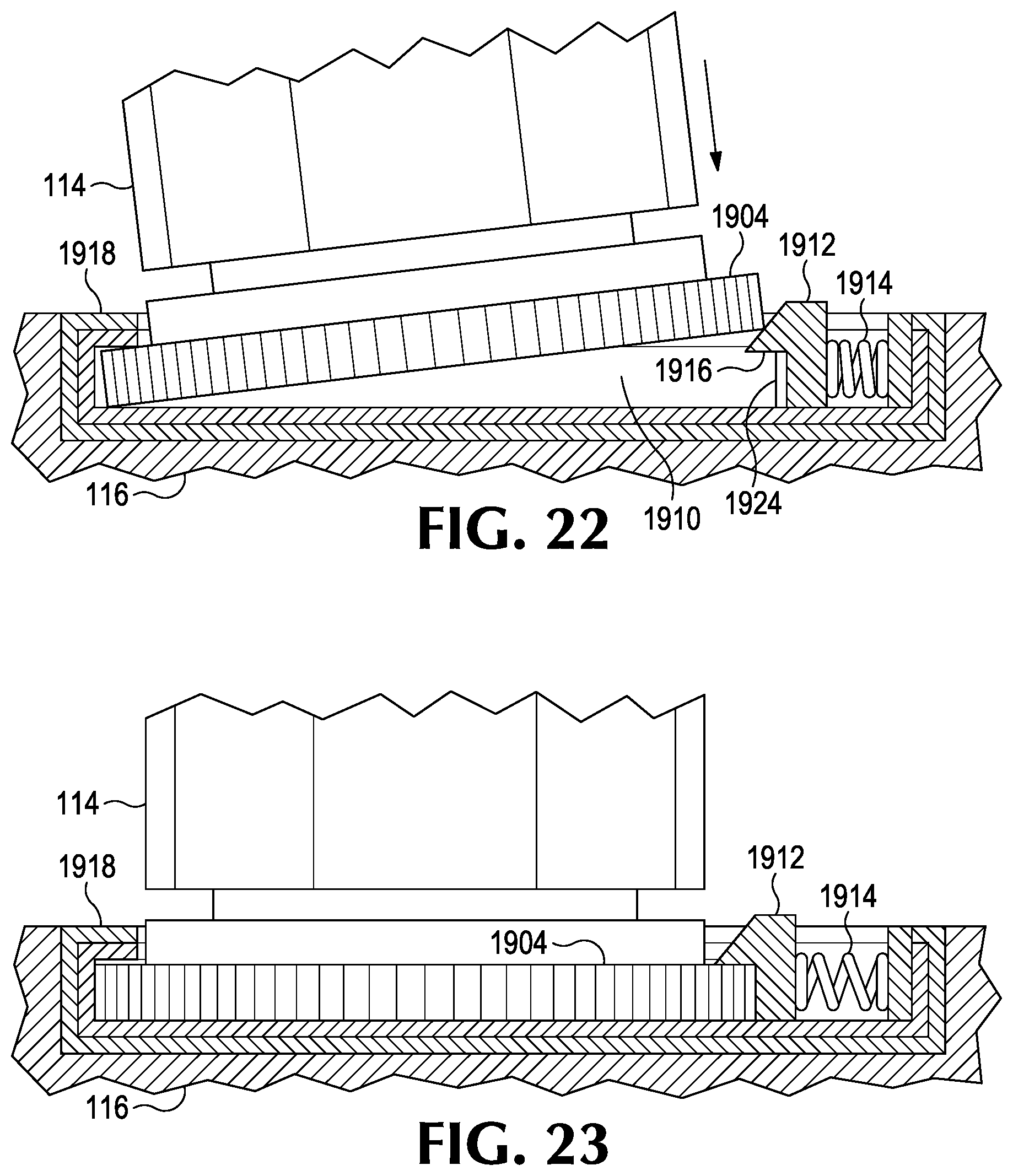 Patent US12551400 Figure 11 – Mechanical compression device with adjustable compression point