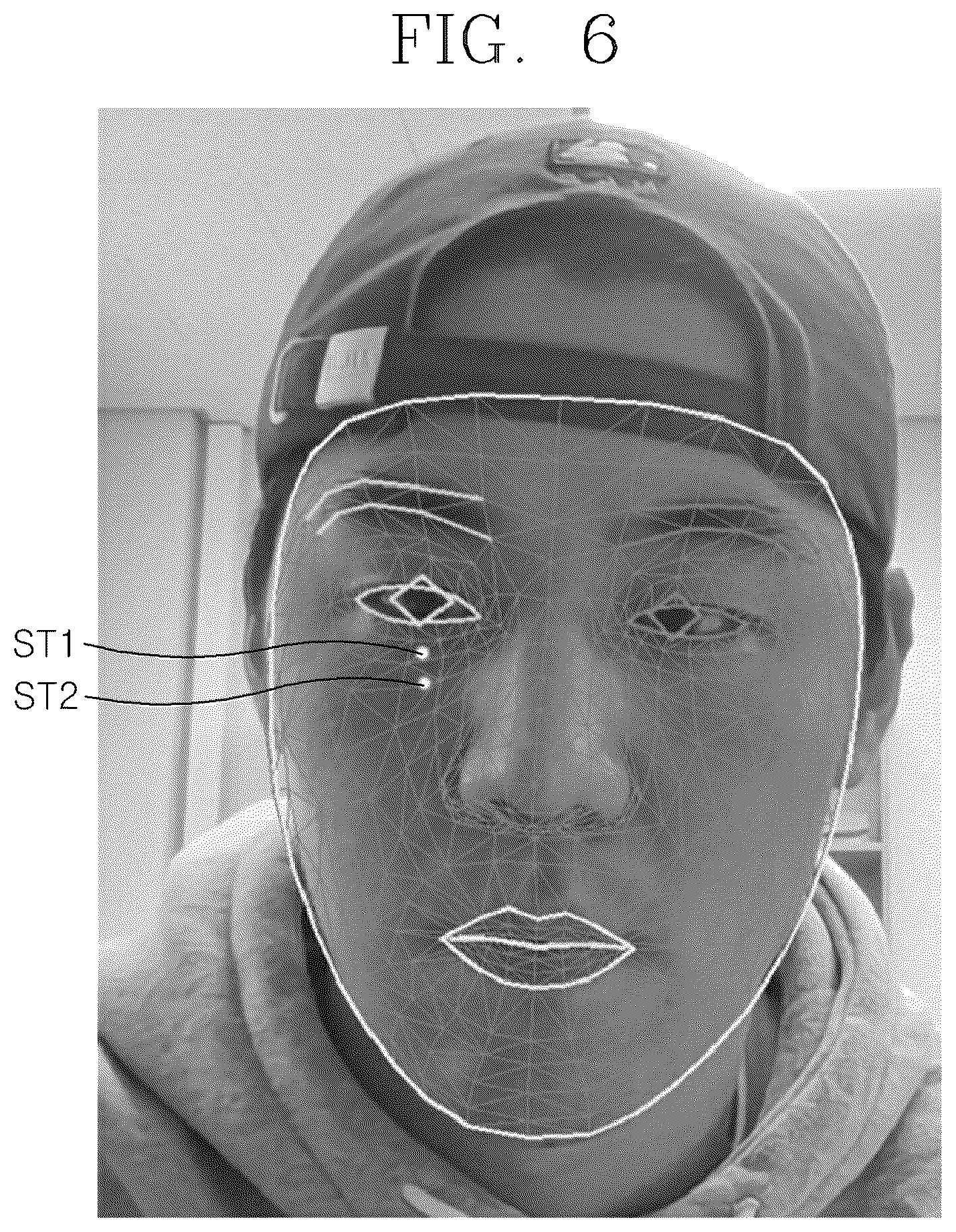 Patent US12551402 Figure 6 – Method of displaying locations of acupuncture points in human body using artificial intelligence