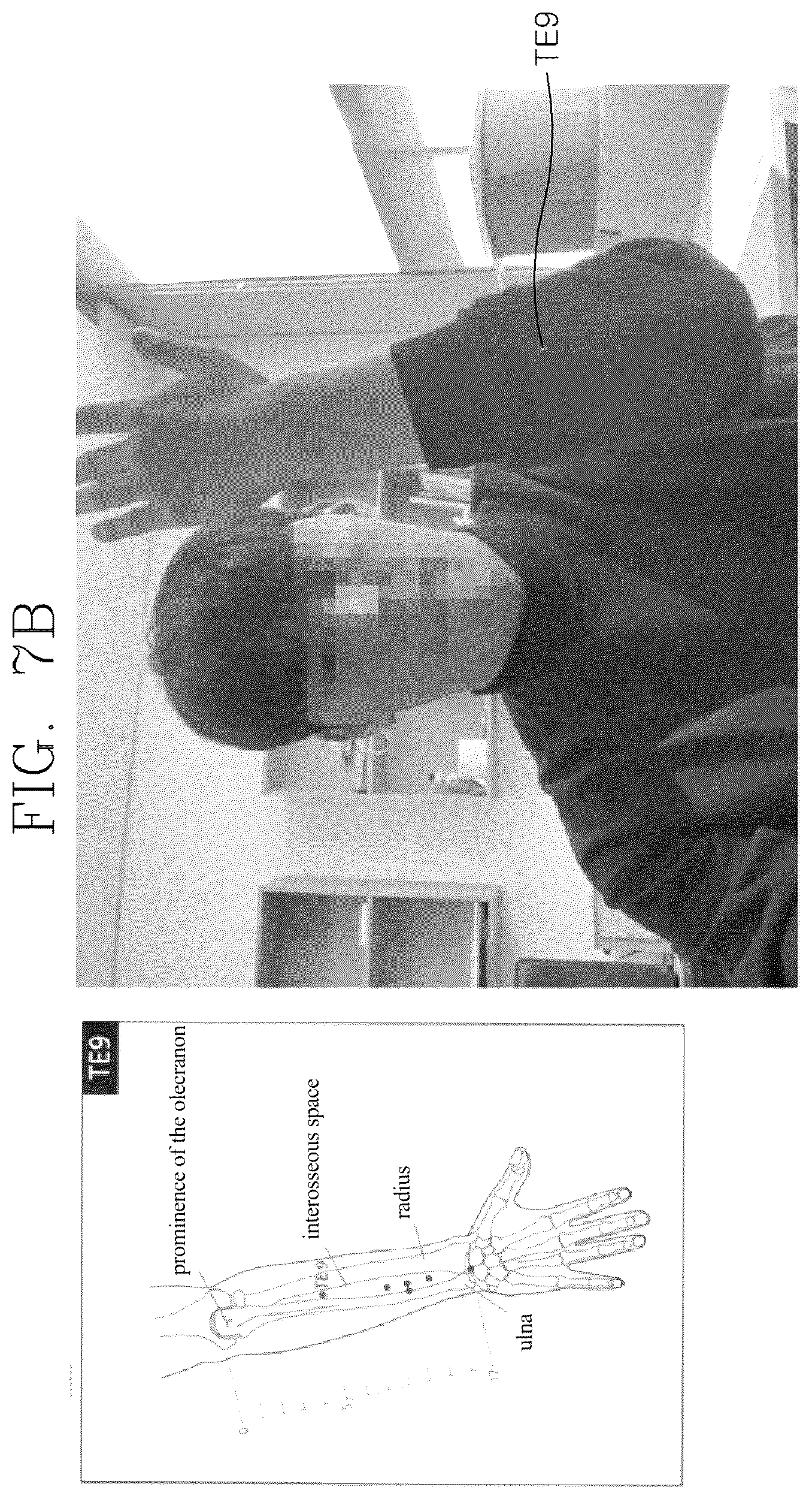 Patent US12551402 Figure 8 – Method of displaying locations of acupuncture points in human body using artificial intelligence