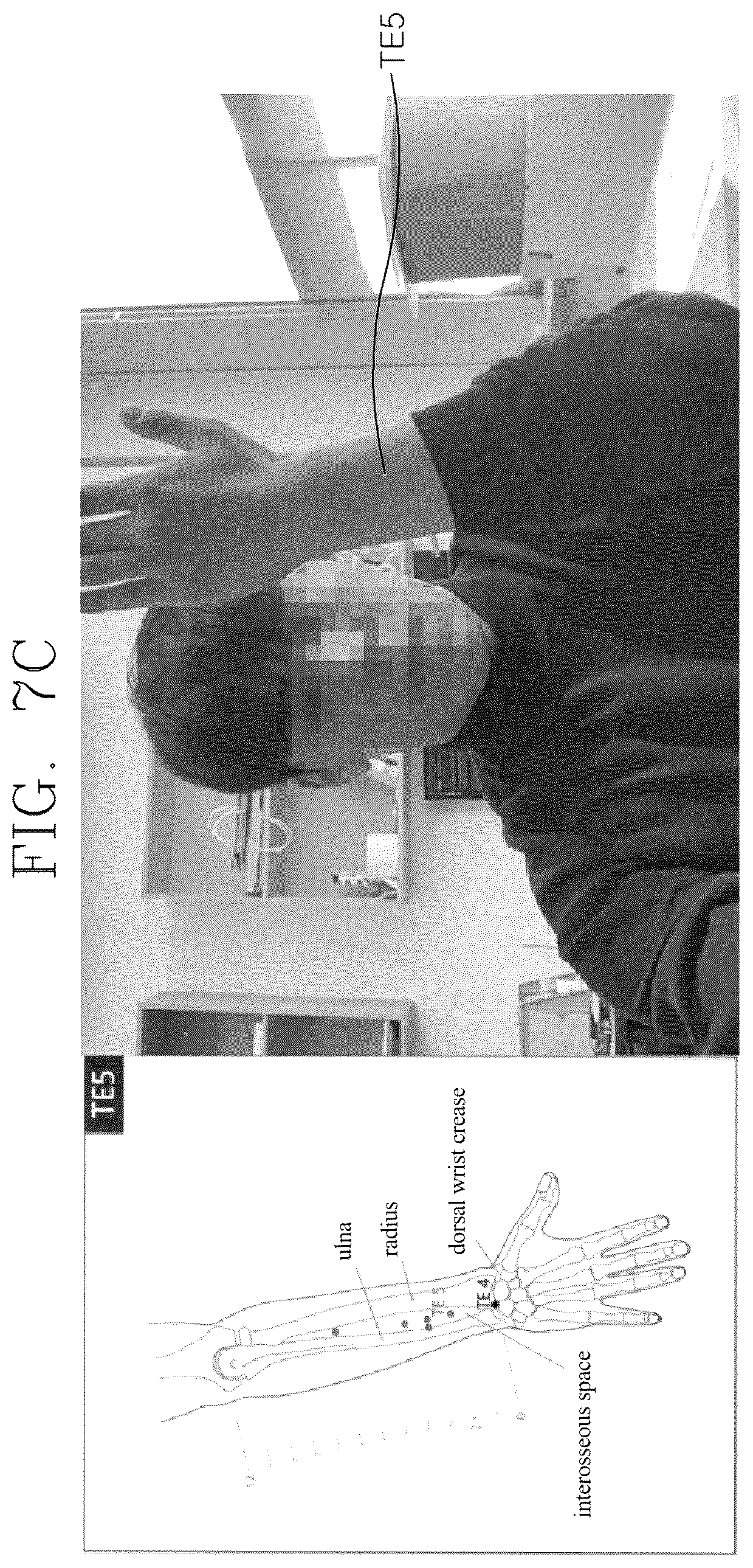 Patent US12551402 Figure 9 – Method of displaying locations of acupuncture points in human body using artificial intelligence