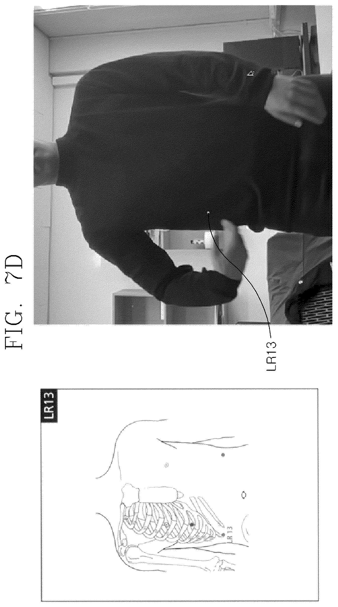 Patent US12551402 Figure 10 – Method of displaying locations of acupuncture points in human body using artificial intelligence