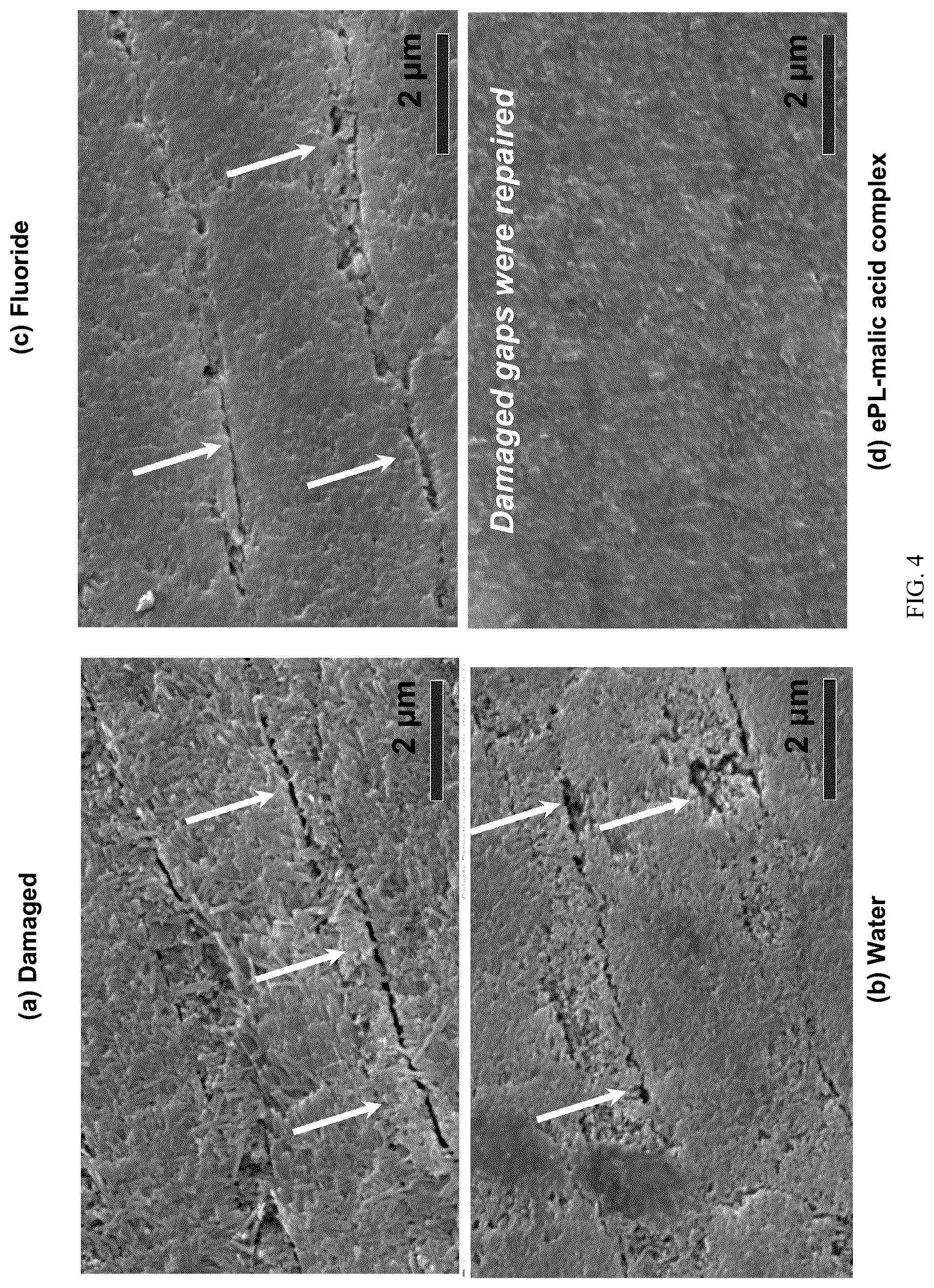 Patent US12551429 Figure 4 – Oral care complexes and compositions