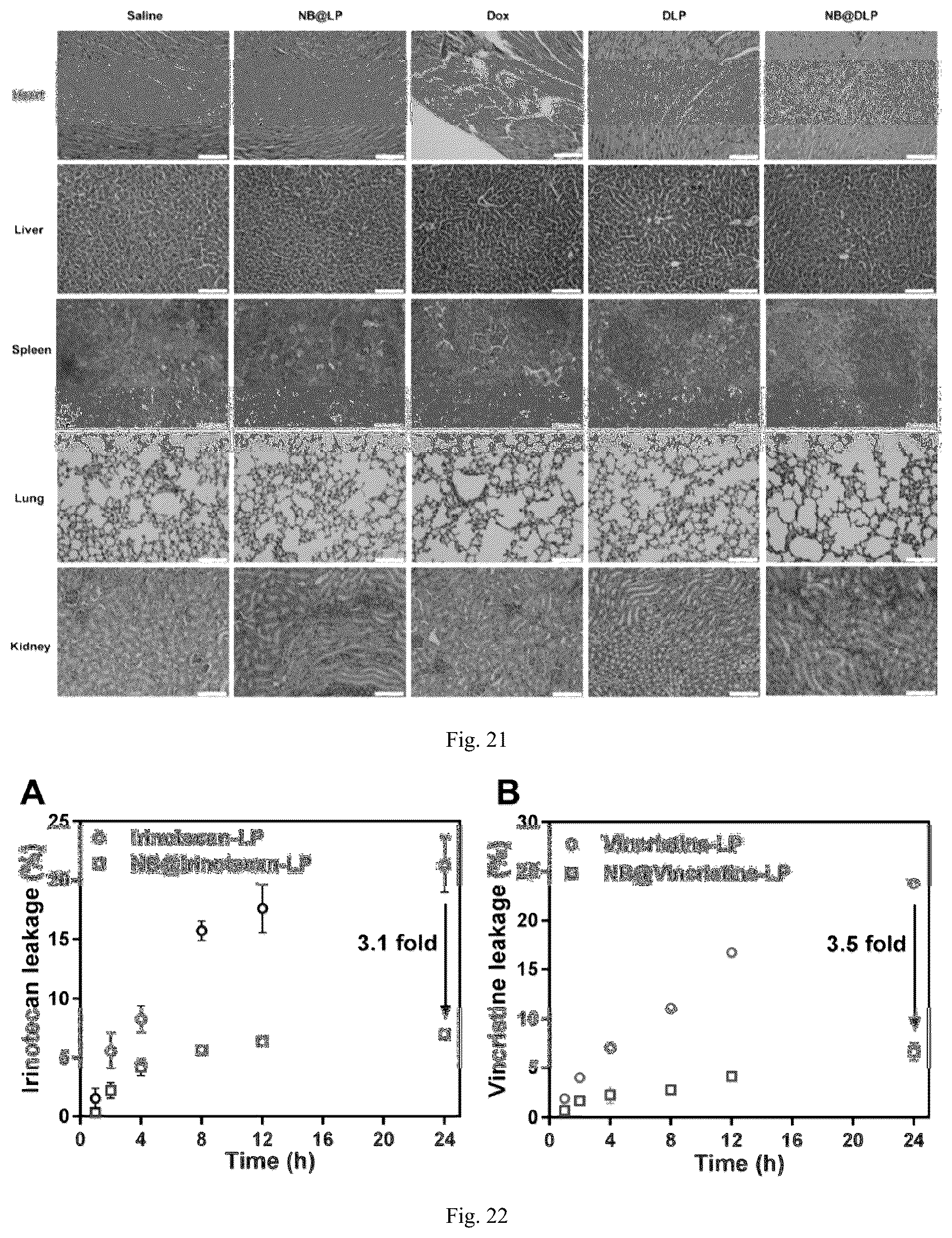 Patent US12551438 Figure 9 – Nanobowl-supported drug-loaded liposome, preparation method therefor and application thereof