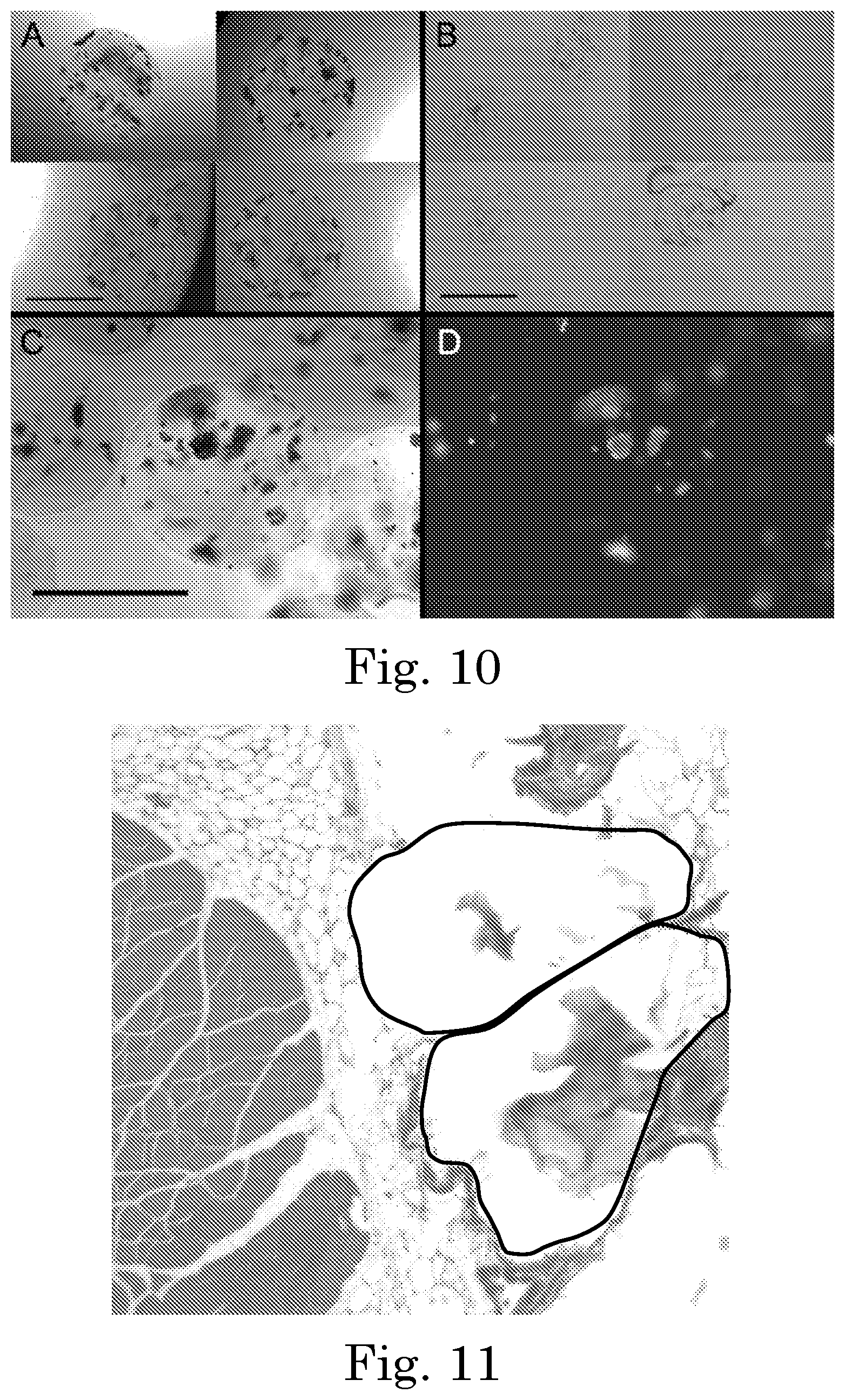 Patent US12551449 Figure 8 – Tunable degradation in hydrogel microparticles