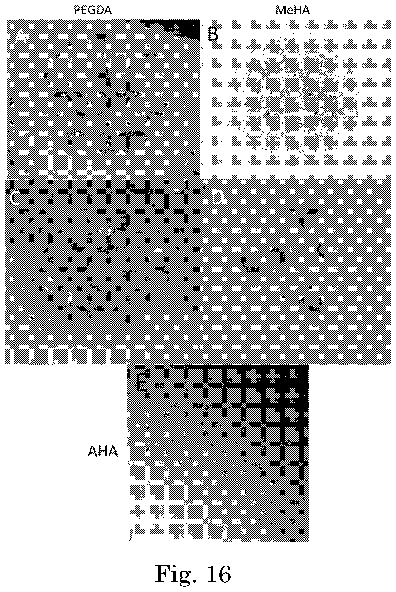 Patent US12551449 Figure 11 – Tunable degradation in hydrogel microparticles