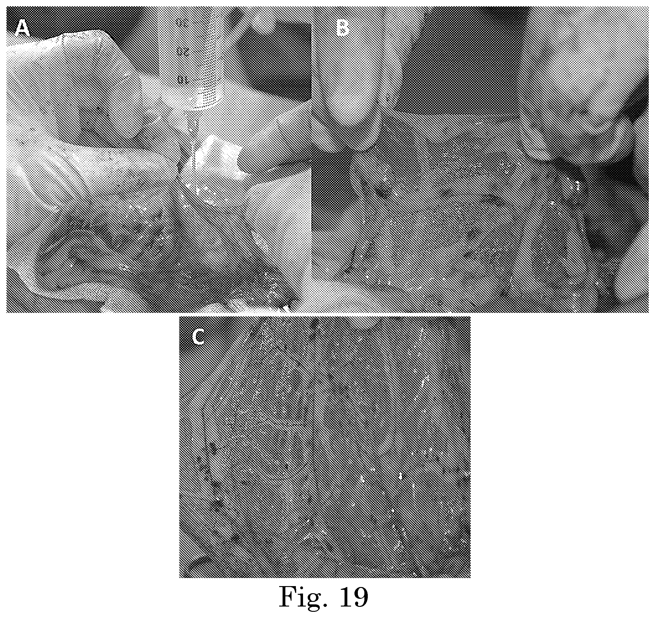 Patent US12551449 Figure 13 – Tunable degradation in hydrogel microparticles