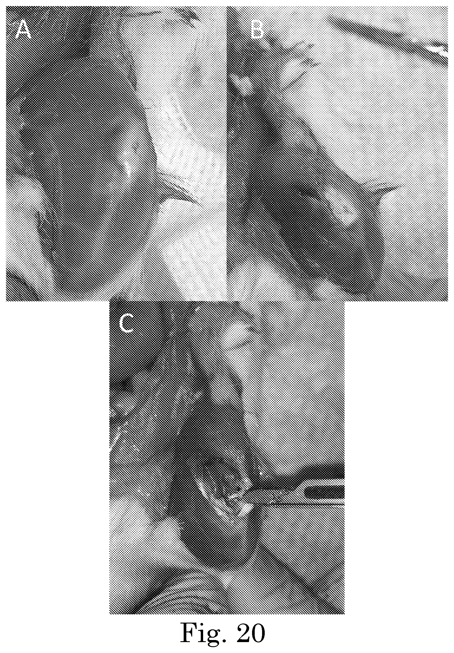 Patent US12551449 Figure 14 – Tunable degradation in hydrogel microparticles