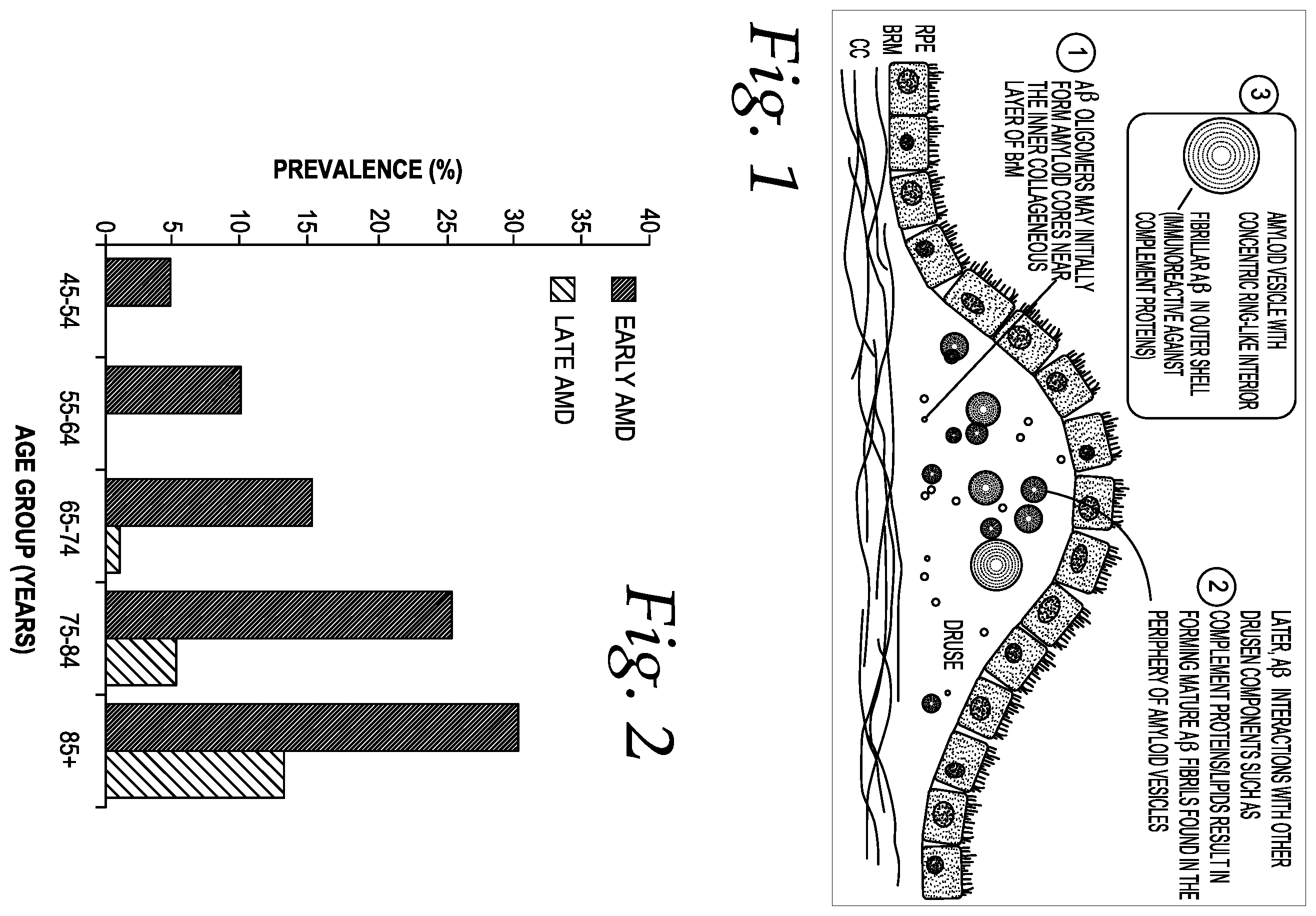 Patent US12551453 Figure 1 – Compositions and methods of treating age-related macular degeneration