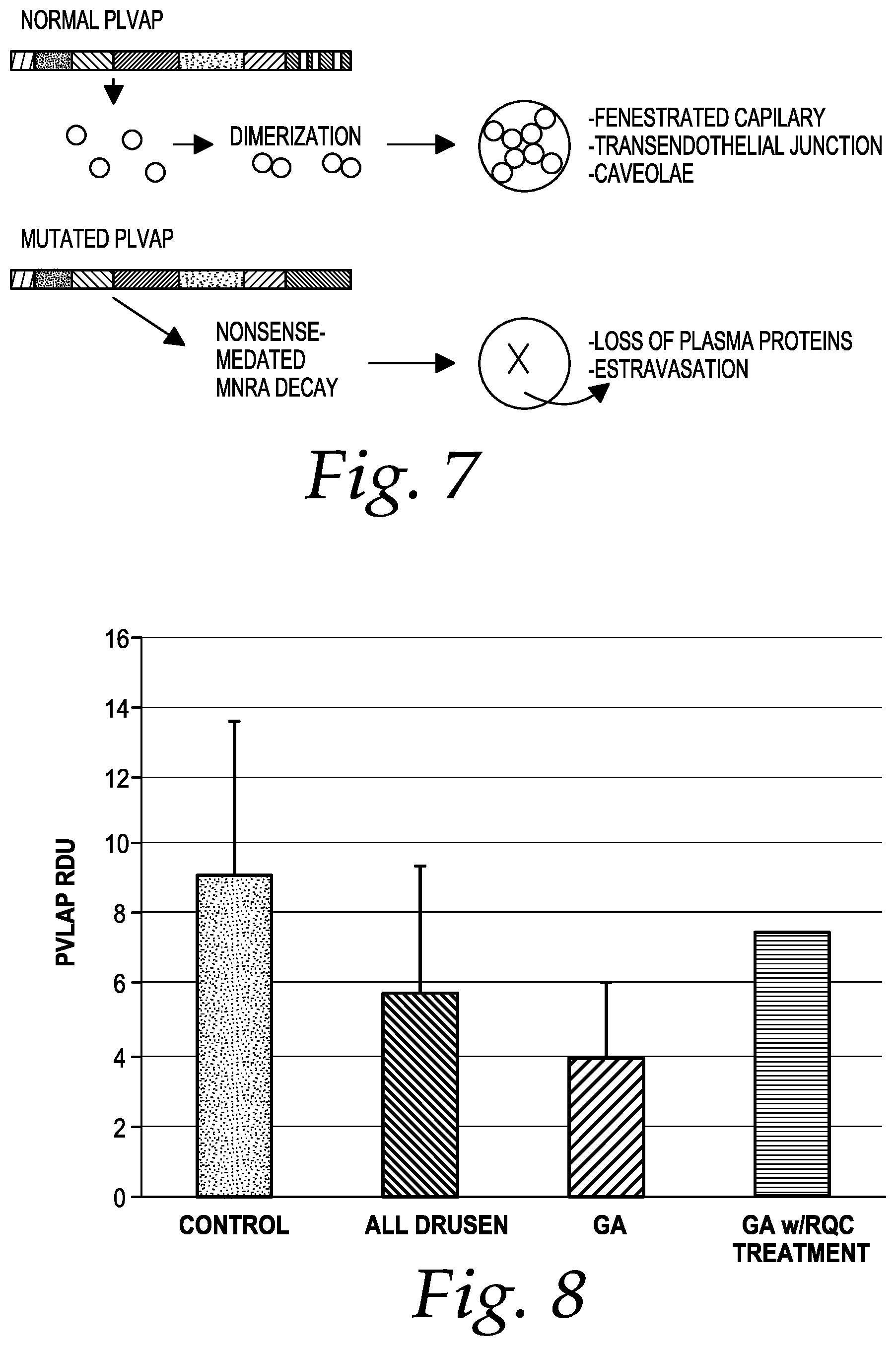 Patent US12551453 Figure 4 – Compositions and methods of treating age-related macular degeneration