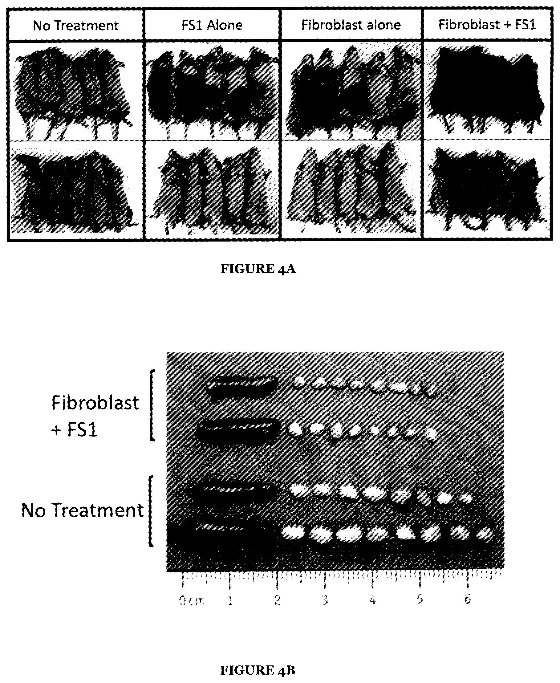 Patent US12551459 Figure 4 – Combination of kynurenine and antigen presenting cells (APC) as therapeutics and methods for their use in immune modulation