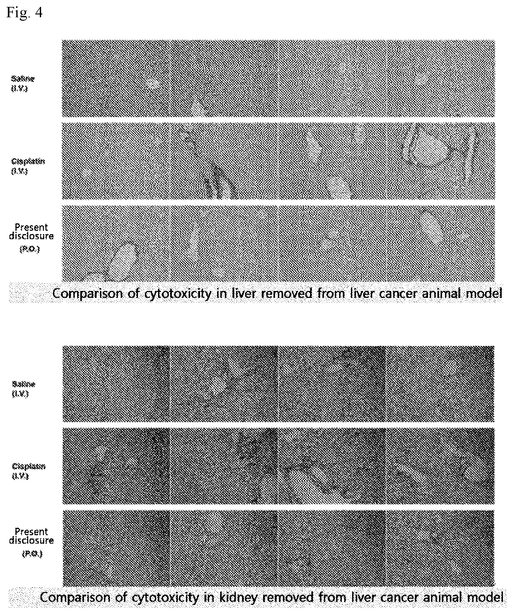 Patent US12551468 Figure 4 – Pharmaceutical composition for oral administration, for treatment of liver cancer
