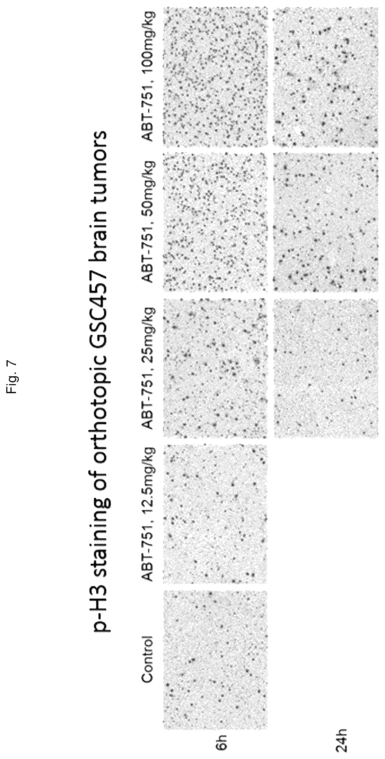 Patent US12551471 Figure 11 – ABT-751 and ionizing radiation