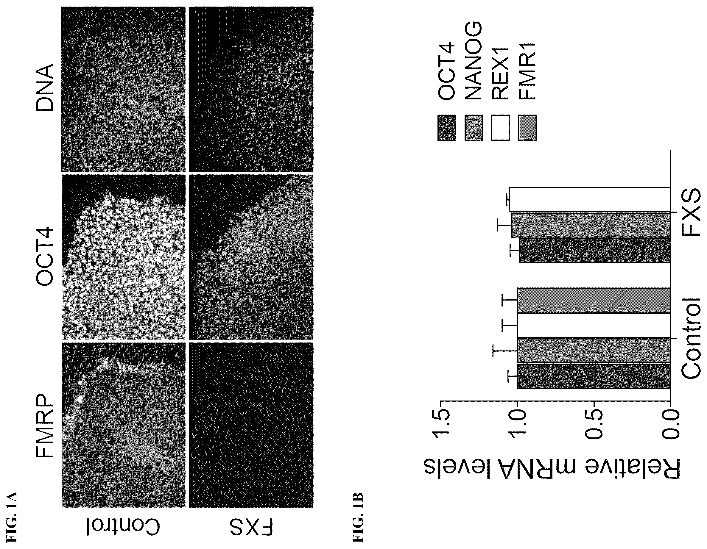 Patent US12551474 Figure 1 – Use of pridopidine for the treatment of fragile X syndrome