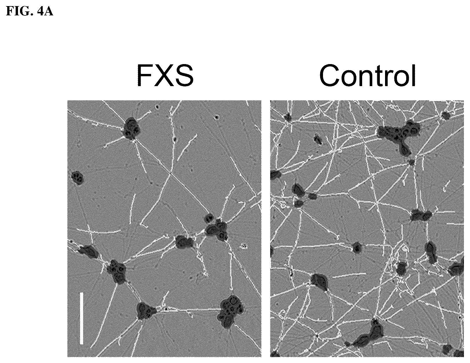 Patent US12551474 Figure 5 – Use of pridopidine for the treatment of fragile X syndrome