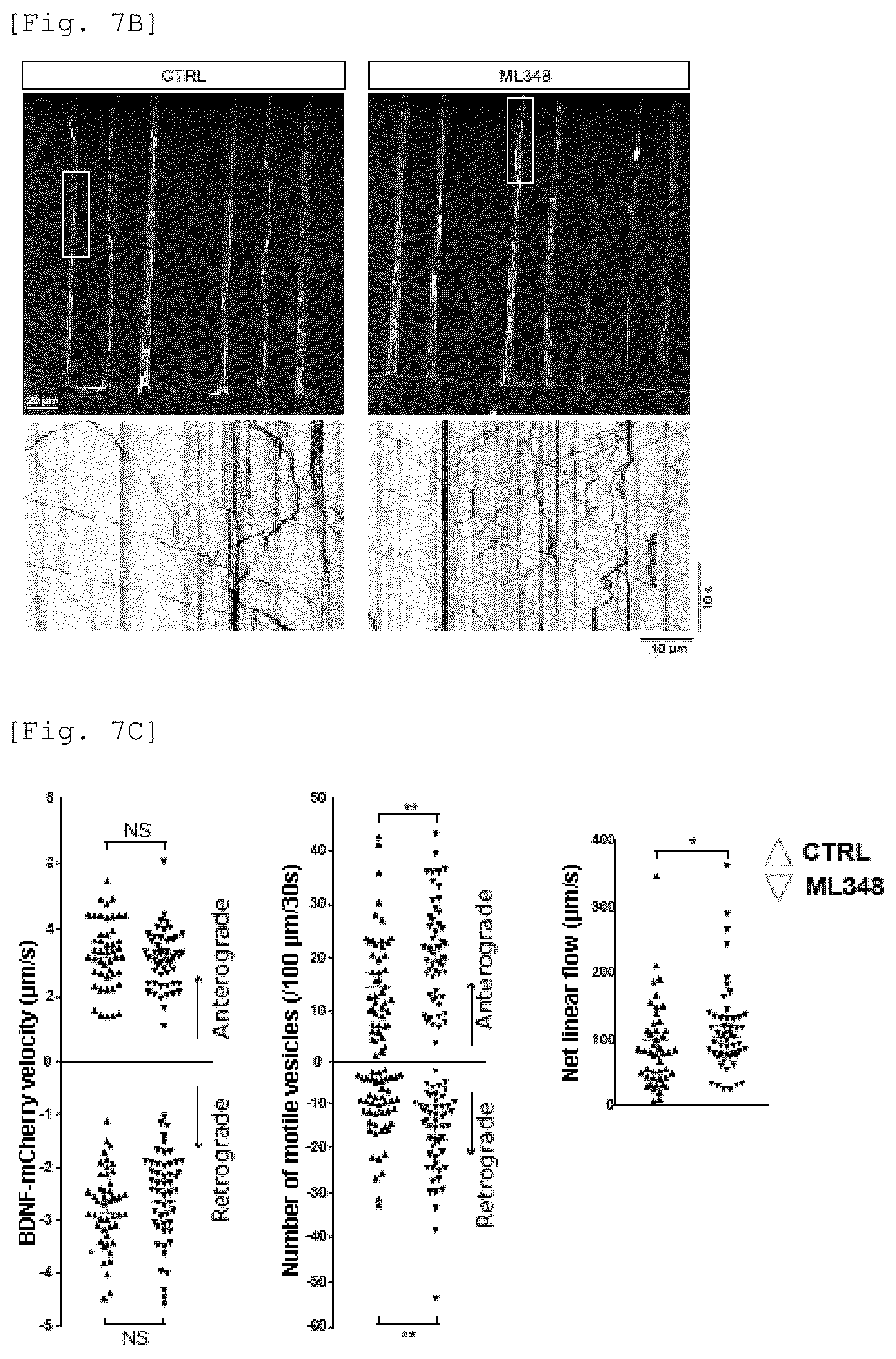 Patent US12551479 Figure 20 – Acyl-protein thioesterase inhibitor for the treatment and/or prevention of Huntington's disease