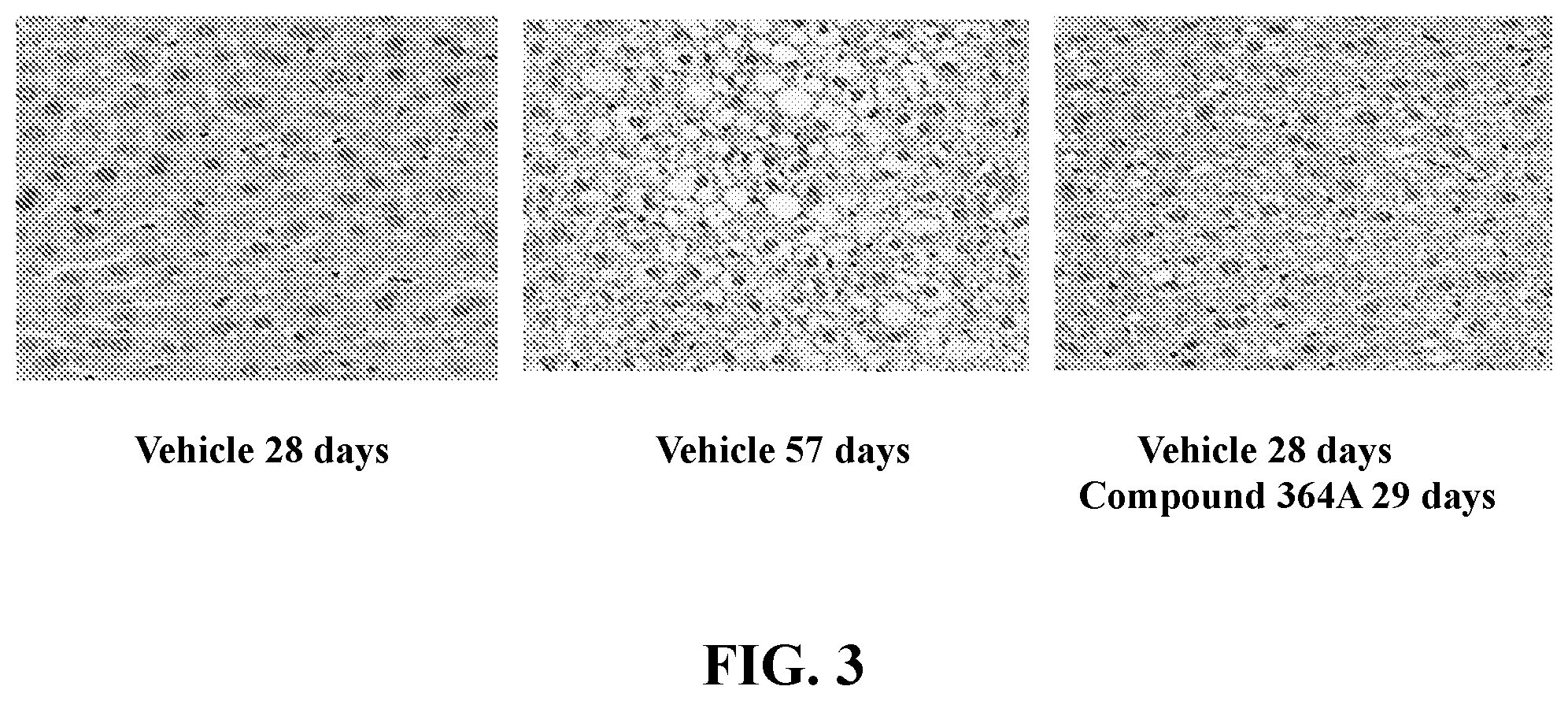 Patent US12551490 Figure 3 – Heterocyclic modulators of lipid synthesis