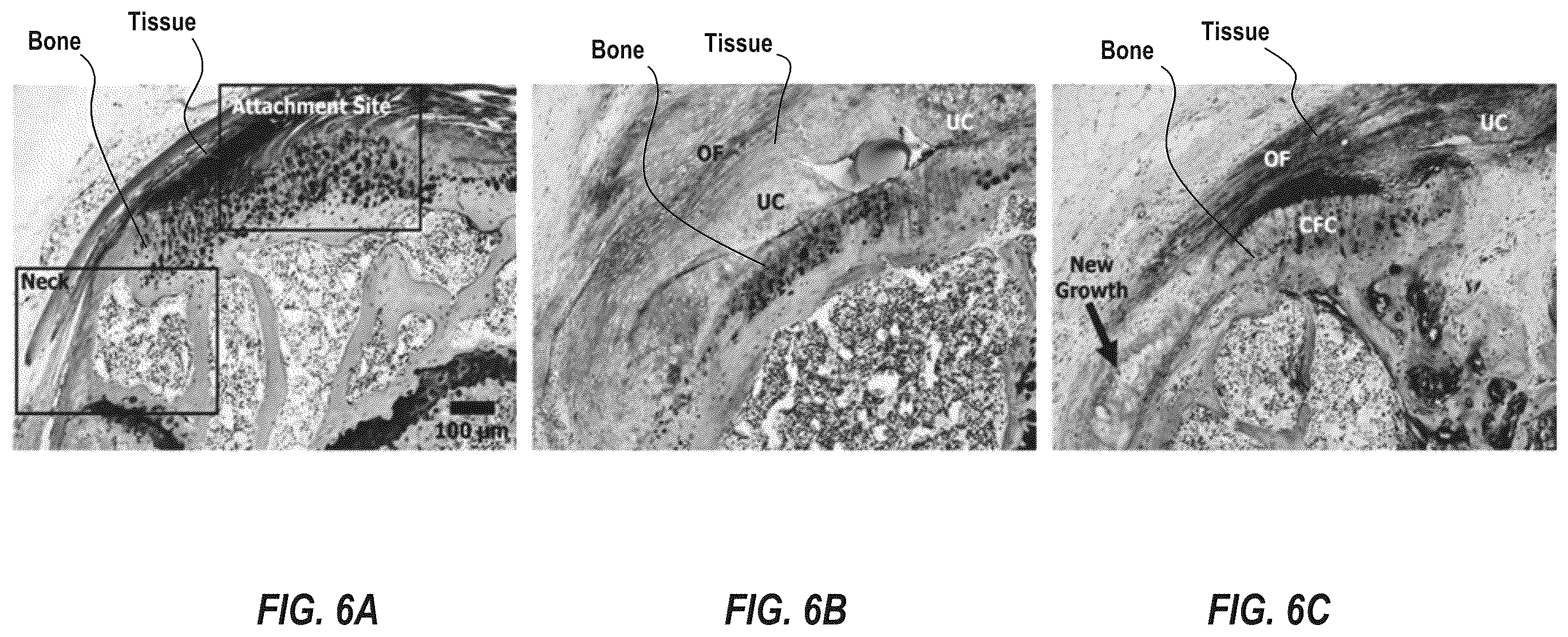 Patent US12551492 Figure 7 – Enthesis healing