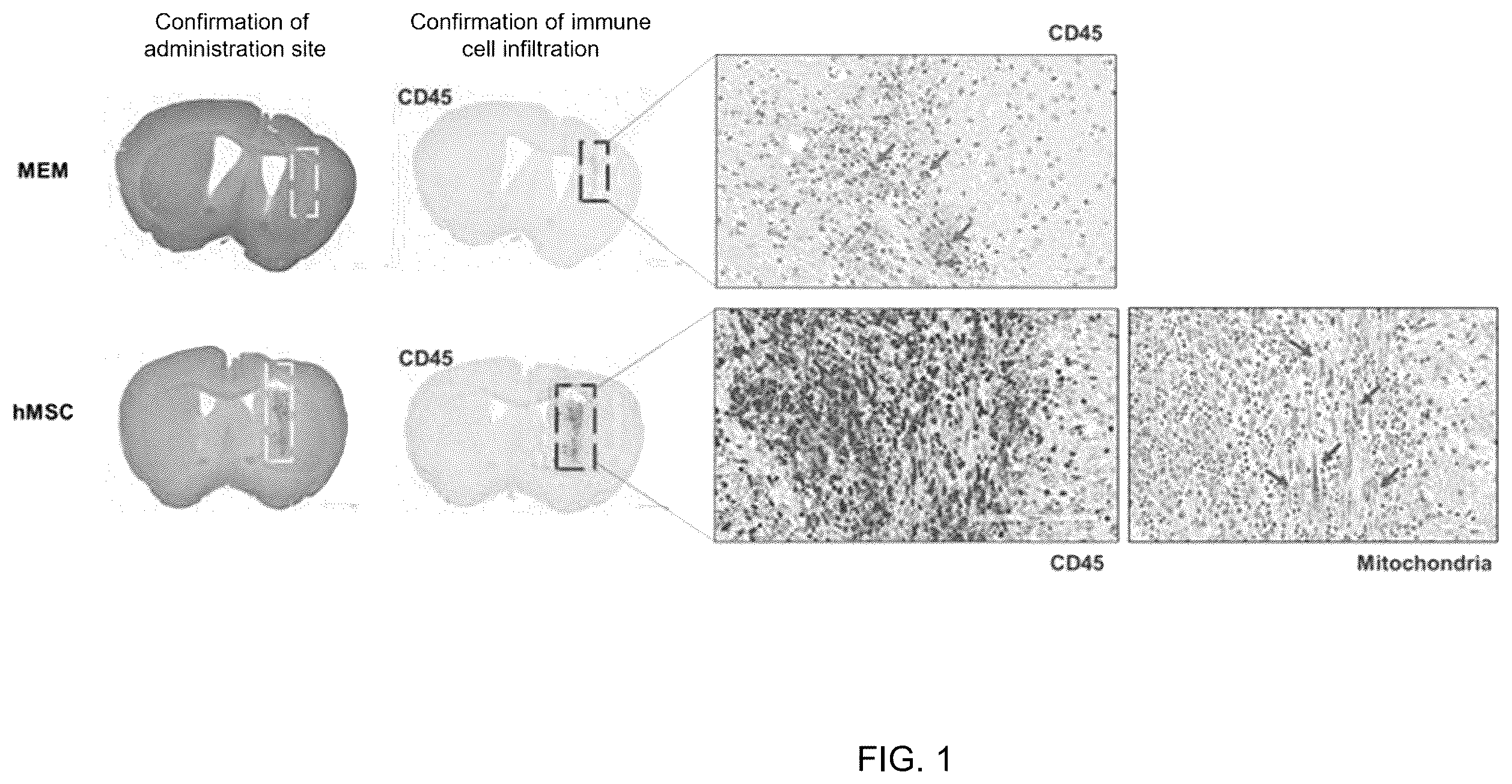 Patent US12551493 Figure 1 – Composition for enhancing therapeutic effect of stem cell, comprising immunosuppressant, and method for enhancing therapeutic effect of stem cell using same