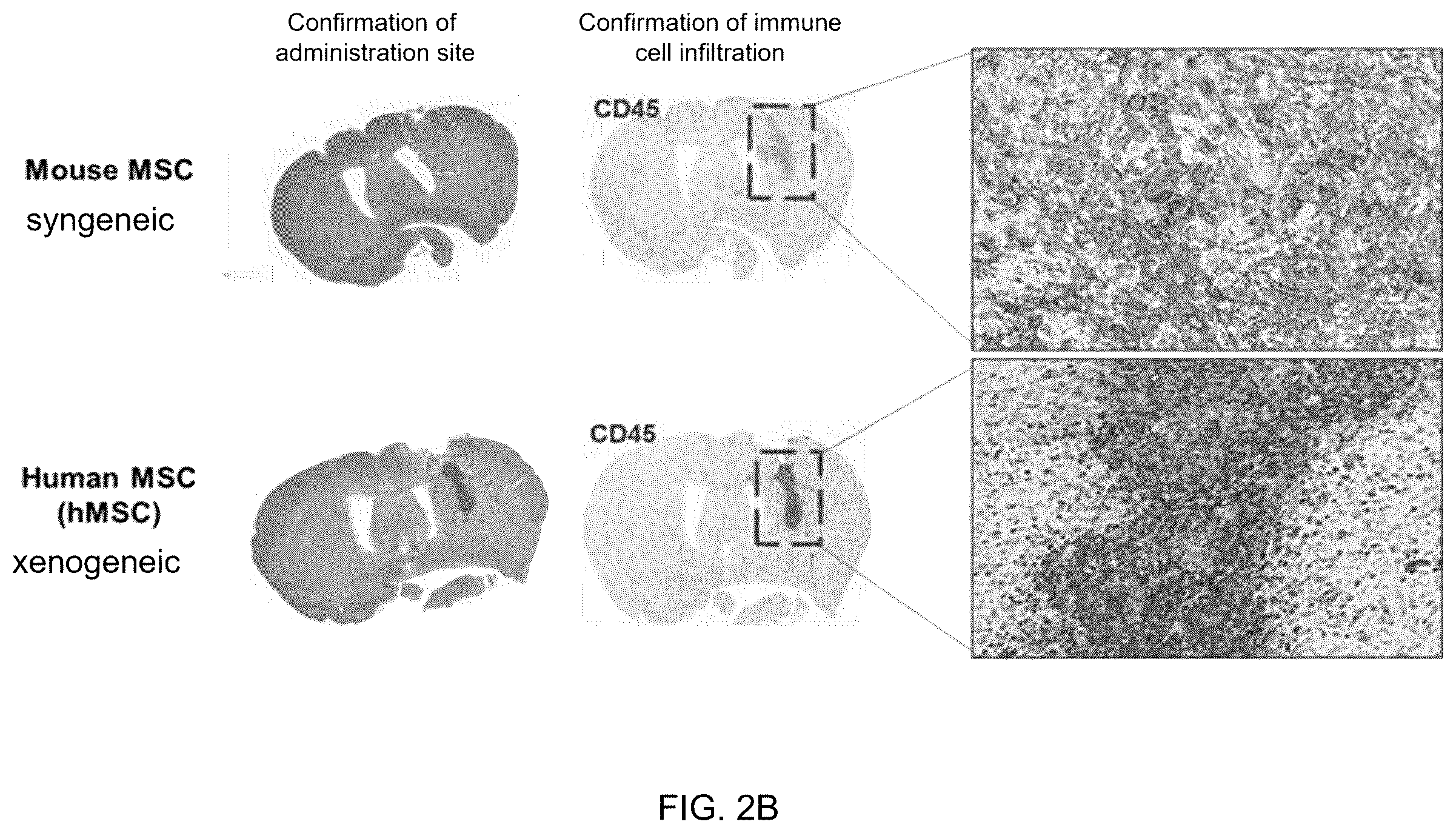 Patent US12551493 Figure 3 – Composition for enhancing therapeutic effect of stem cell, comprising immunosuppressant, and method for enhancing therapeutic effect of stem cell using same
