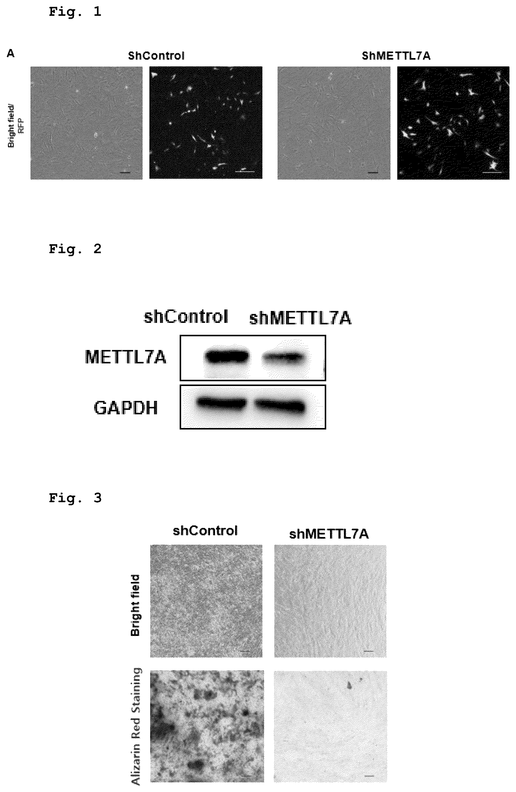 Patent US12551505 Figure 1 – Composition for bone regeneration comprising METTL7A overexpressing stem cells, method for preparing same, and cell therapy product comprising same