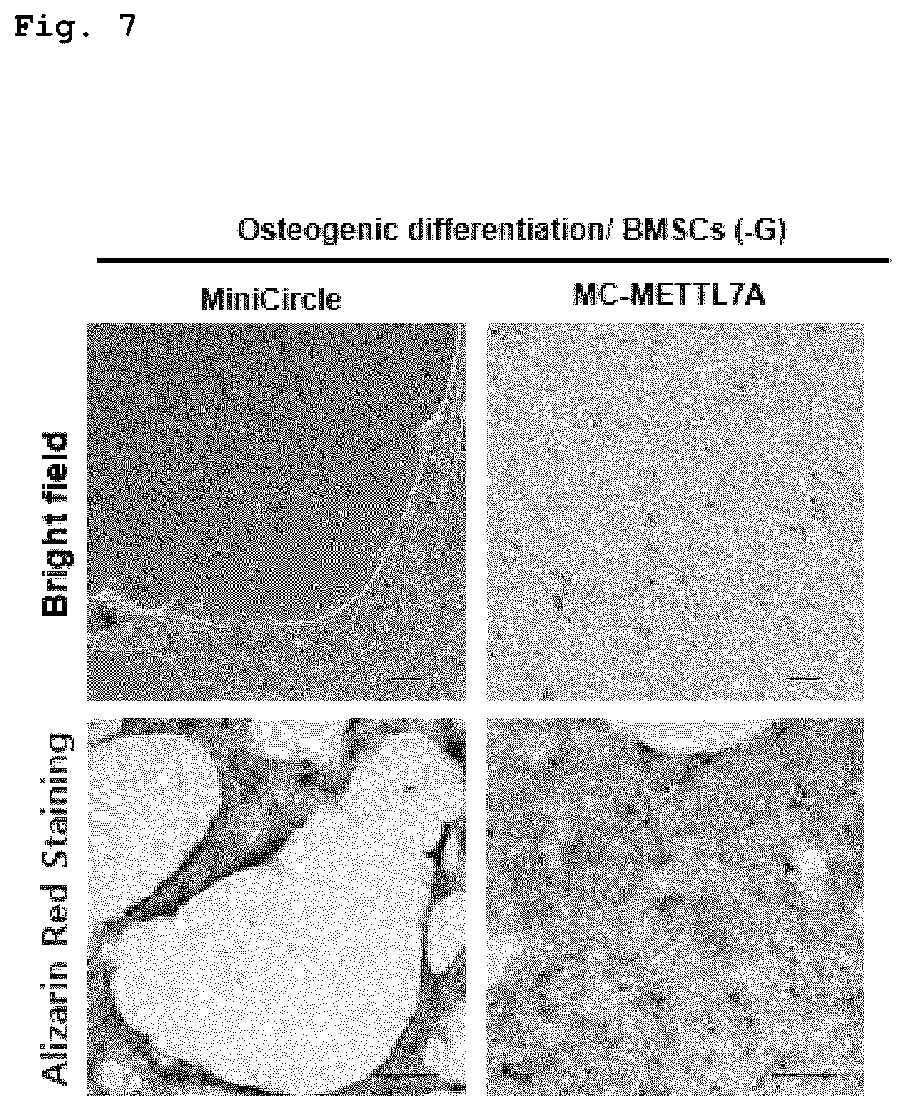 Patent US12551505 Figure 4 – Composition for bone regeneration comprising METTL7A overexpressing stem cells, method for preparing same, and cell therapy product comprising same