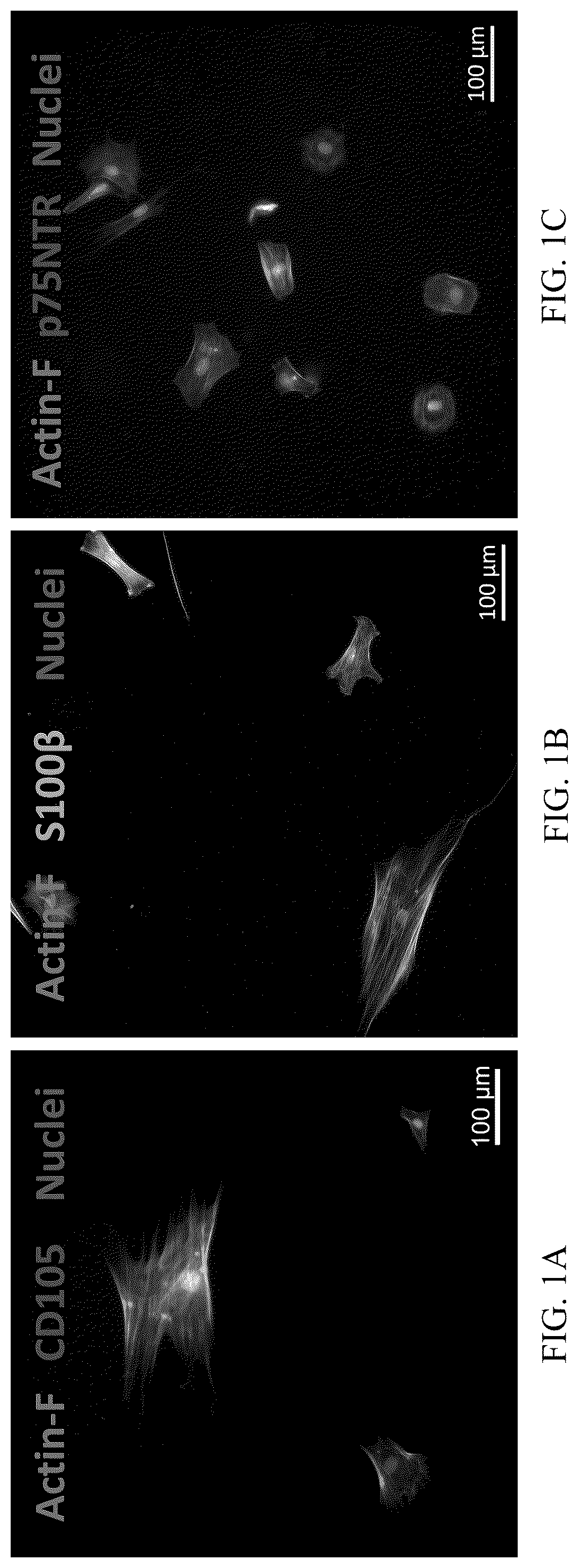 Patent US12551506 — Differentiation of olfactory mucosa derived mesenchymal stem cells to schwann cells for peripheral nerve repair — Figure 1