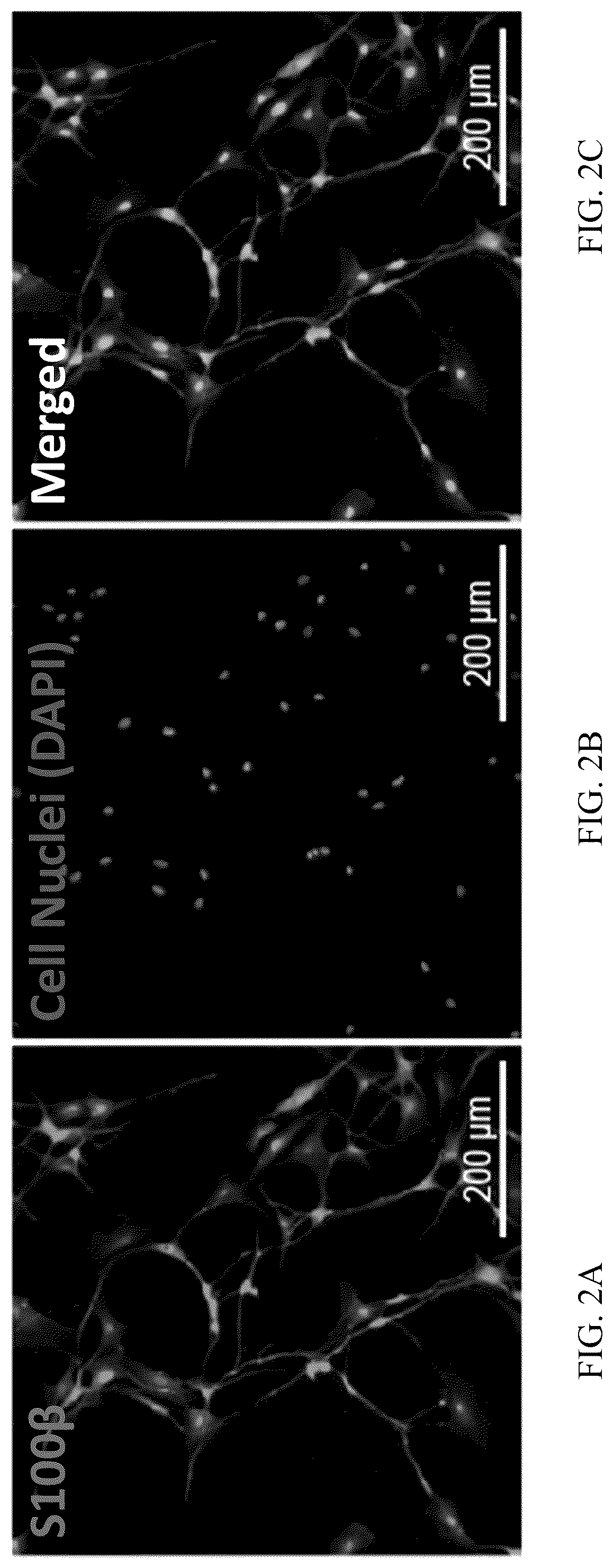 Patent US12551506 Figure 2 – Differentiation of olfactory mucosa derived mesenchymal stem cells to schwann cells for peripheral nerve repair