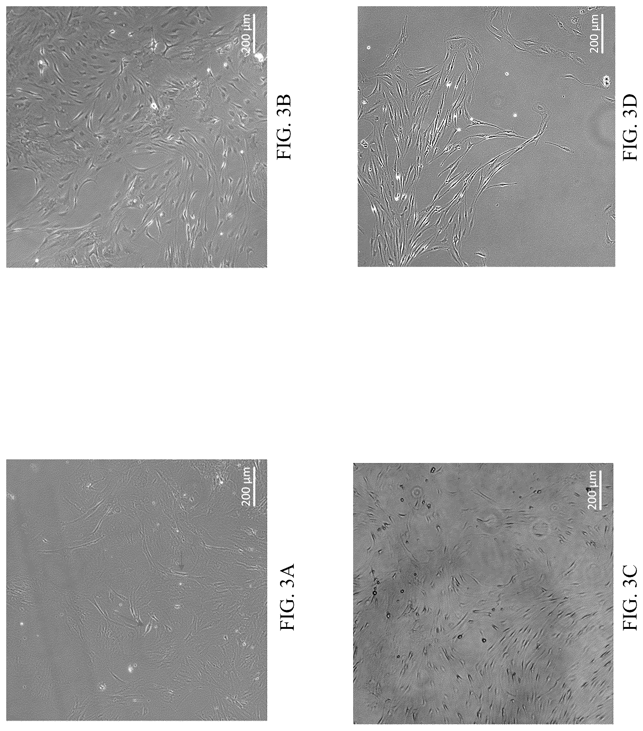 Patent US12551506 Figure 3 – Differentiation of olfactory mucosa derived mesenchymal stem cells to schwann cells for peripheral nerve repair
