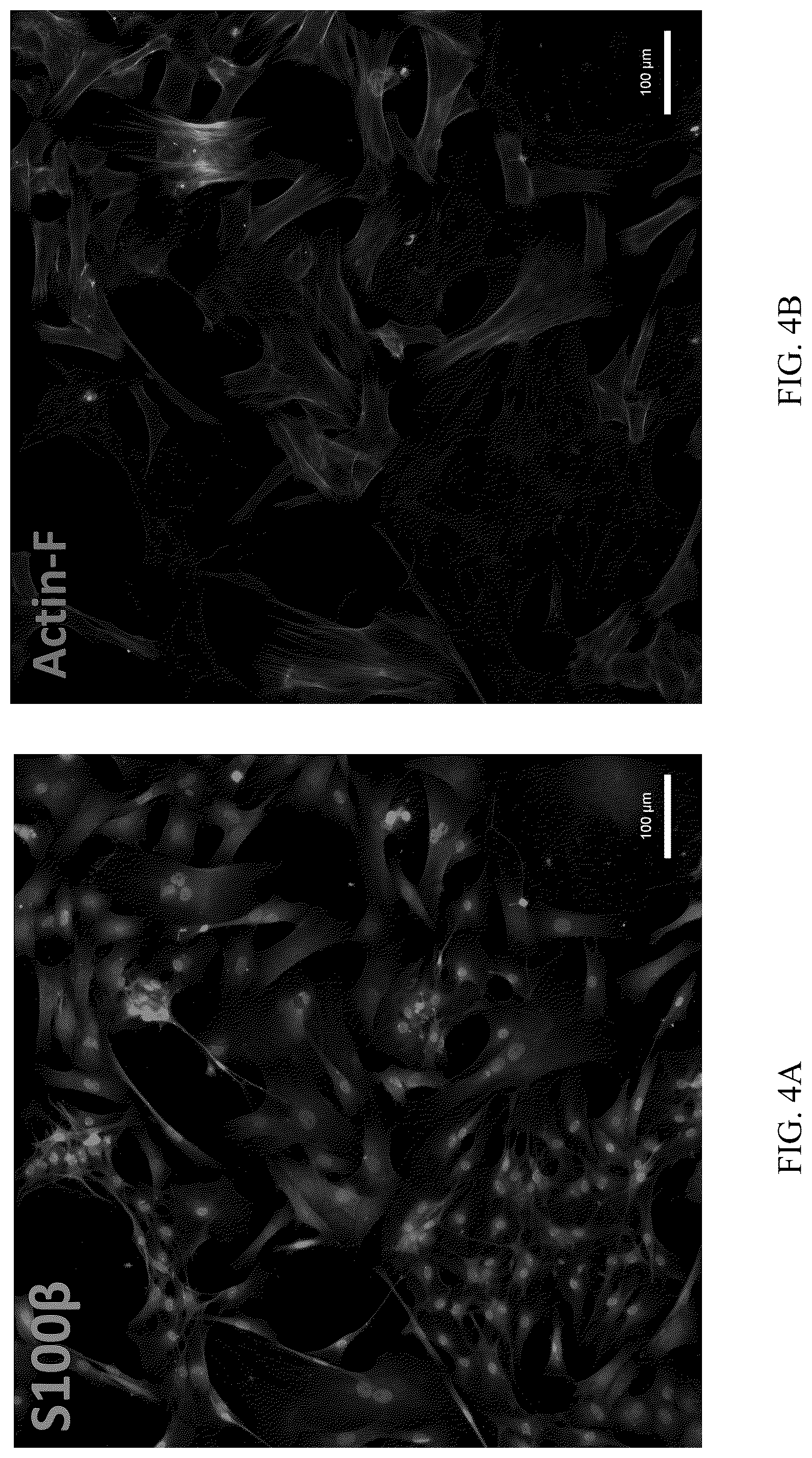Patent US12551506 Figure 4 – Differentiation of olfactory mucosa derived mesenchymal stem cells to schwann cells for peripheral nerve repair
