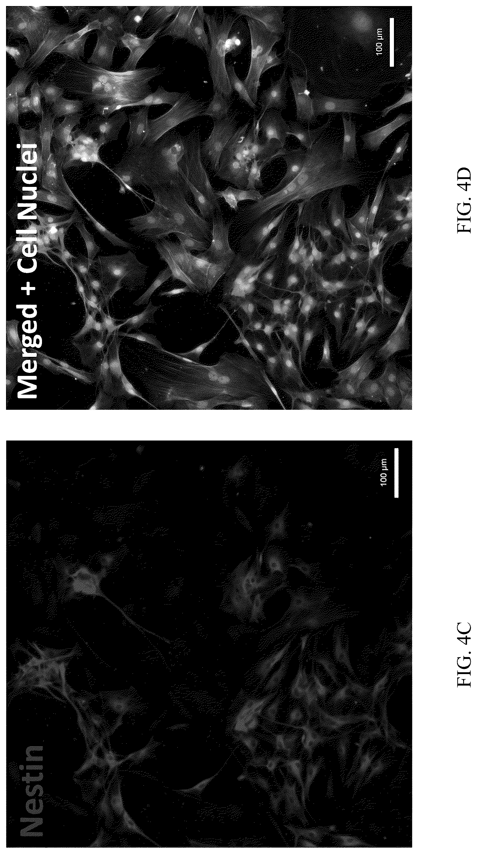 Patent US12551506 Figure 5 – Differentiation of olfactory mucosa derived mesenchymal stem cells to schwann cells for peripheral nerve repair