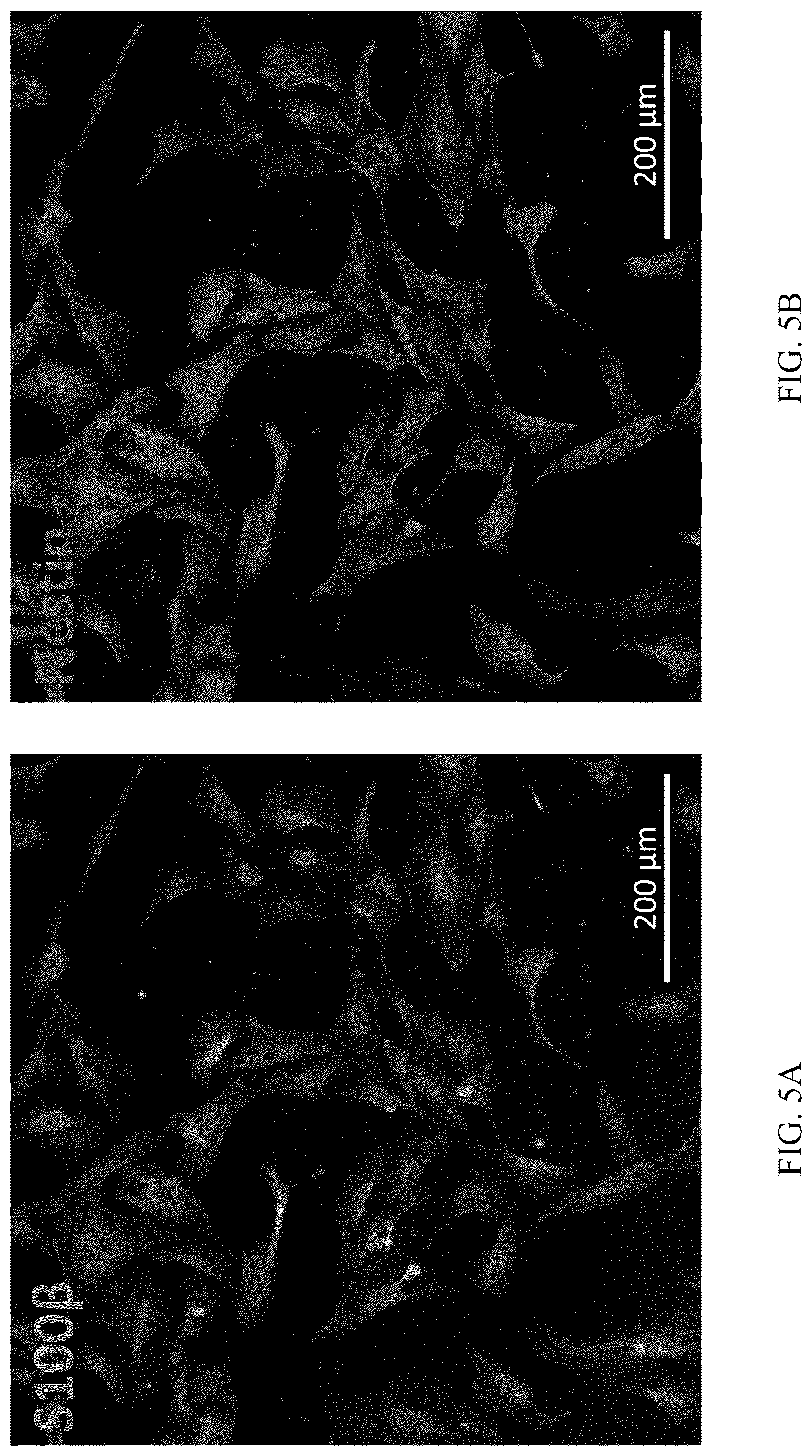 Patent US12551506 Figure 6 – Differentiation of olfactory mucosa derived mesenchymal stem cells to schwann cells for peripheral nerve repair