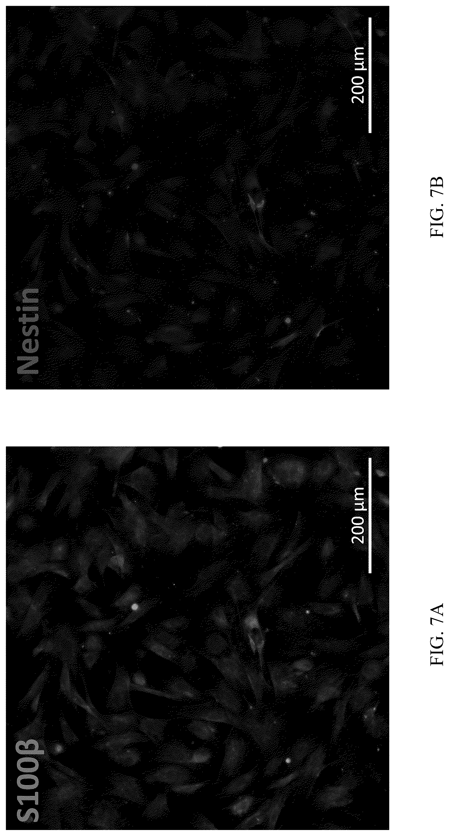 Patent US12551506 Figure 10 – Differentiation of olfactory mucosa derived mesenchymal stem cells to schwann cells for peripheral nerve repair