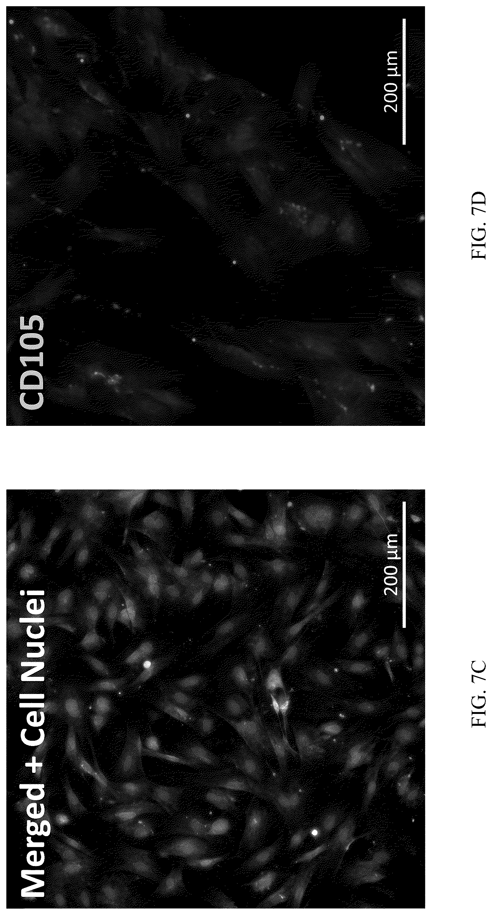 Patent US12551506 Figure 11 – Differentiation of olfactory mucosa derived mesenchymal stem cells to schwann cells for peripheral nerve repair