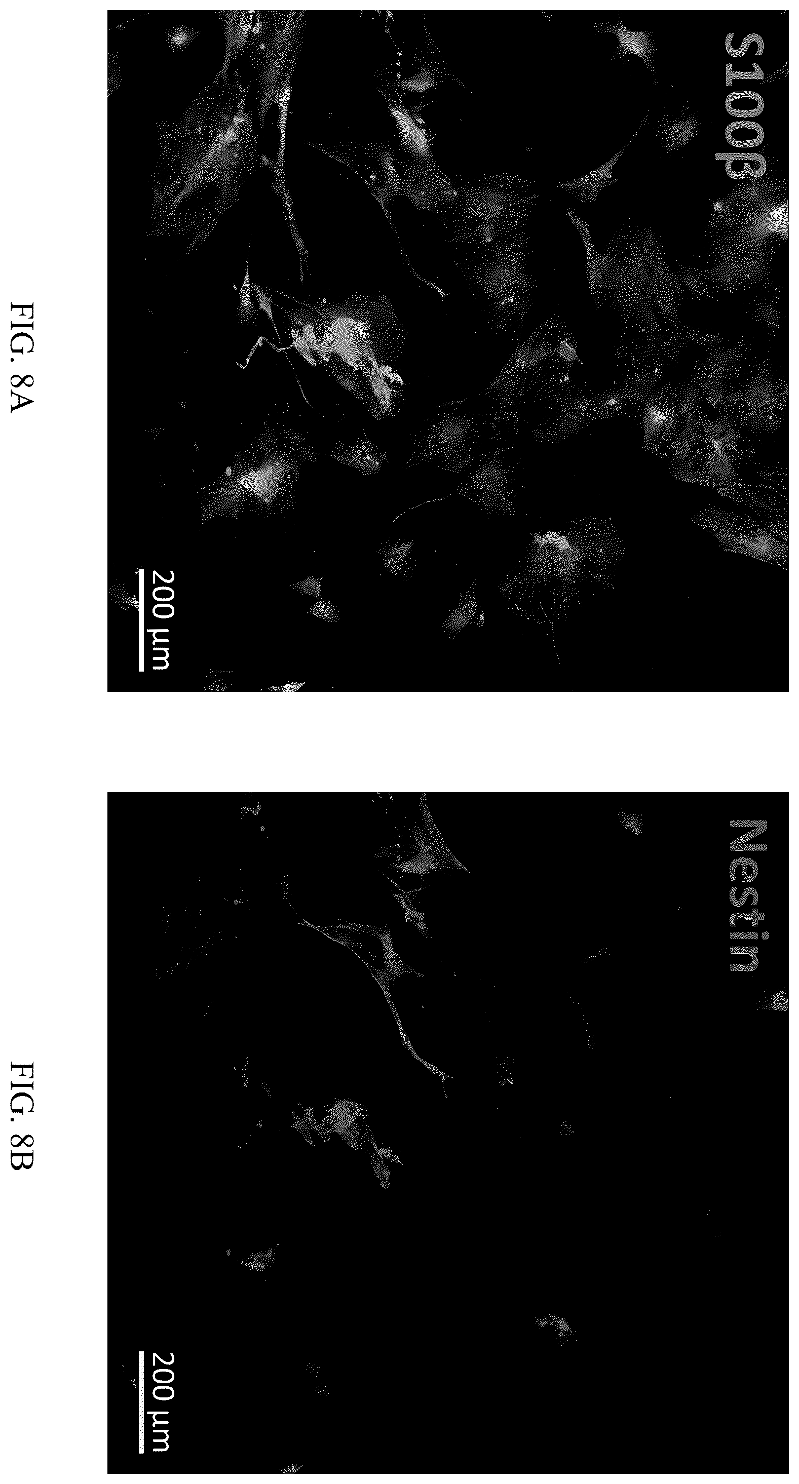 Patent US12551506 Figure 13 – Differentiation of olfactory mucosa derived mesenchymal stem cells to schwann cells for peripheral nerve repair