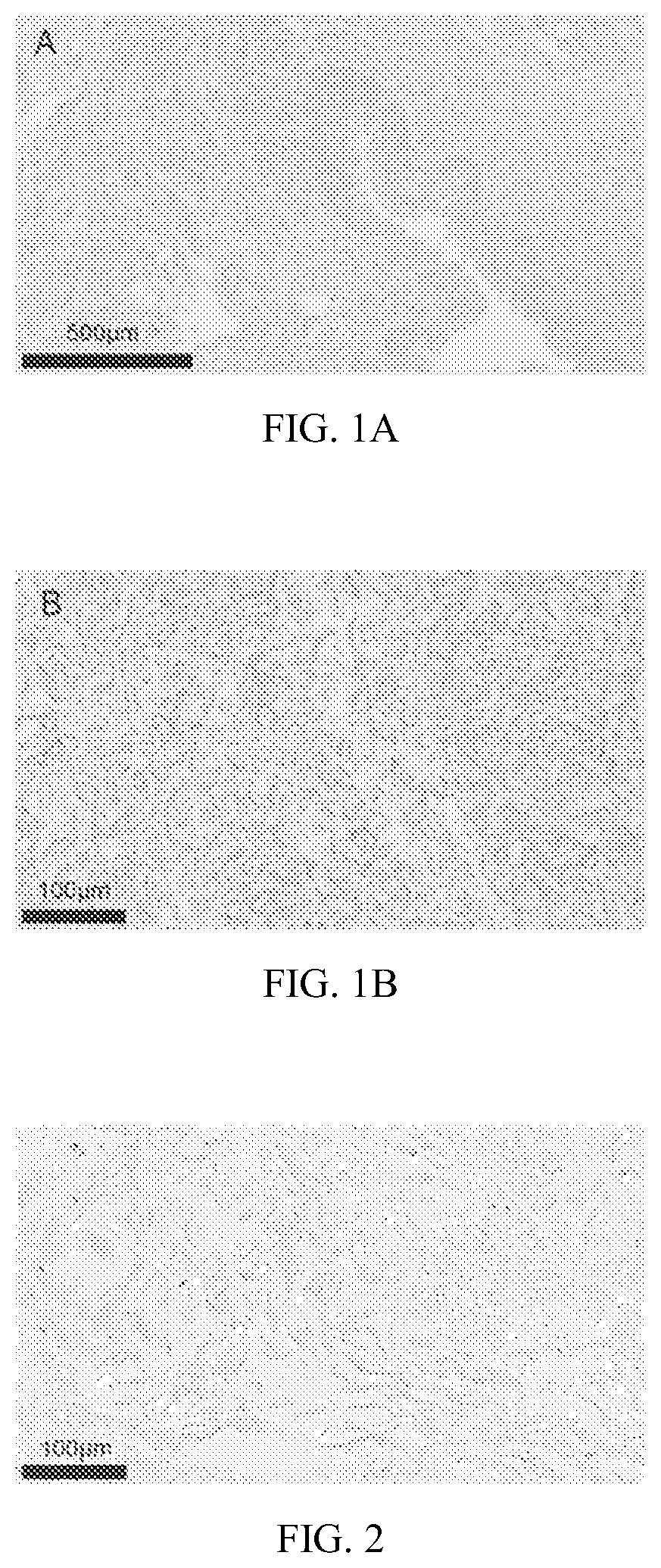 Patent US12551508 Figure 1 – Preparation method for decellularized matrix biomaterial
